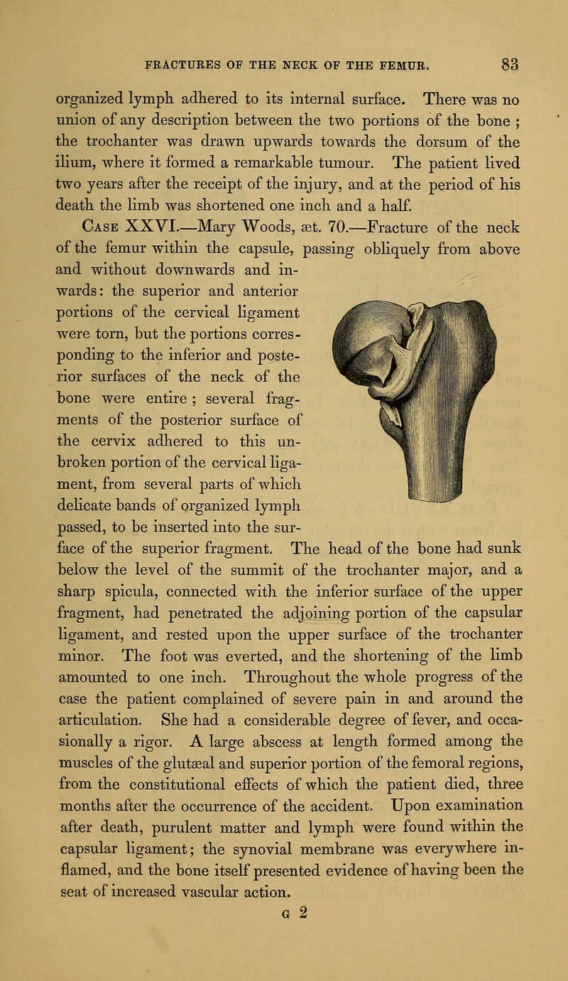 organized lymph adhered to its internal surface. There was no union of any description between the two portions of the bone ; the trochanter was drawn upwards towards the dorsum of the ilium, where it formed a remarkable tumour. The patient lived two years after the receipt of the injury, and at the period of his death the limb was shortened one inch and a half. Case XXVI.—Mary Woods, set. 70.—Fracture of the neck of the femur within the capsule, passing obliquely from above and without downwards and in- wards: the superior and anterior portions of the cervical ligament were torn, but the portions corres- ponding to the inferior and poste- rior surfaces of the neck of the bone were entire ; several frag- ments of the posterior surface of the cervix adhered to this un- broken portion of the cervical liga- ment, from several parts of which delicate bands of organized lymph passed, to be inserted into the sur- face of the superior fragment. The head of the bone had sunk below the level of the summit of the trochanter major, and a sharp spicula, connected with the inferior surface of the upper fragment, had penetrated the adjoining portion of the capsular ligament, and rested upon the upper surface of the trochanter minor. The foot was everted, and the shortening of the limb amounted to one inch. Throughout the whole progress of the case the patient complained of severe pain in and around the articulation. She had a considerable degree of fever, and occa- sionally a rigor. A large abscess at length formed among the muscles of the gluteal and superior portion of the femoral regions, from the constitutional effects of which the patient died, three months after the occurrence of the accident. Upon examination after death, purulent matter and lymph were found within the capsular ligament; the synovial membrane was everywhere in- flamed, and the bone itself presented evidence of having been the seat of increased vascular action. g 2