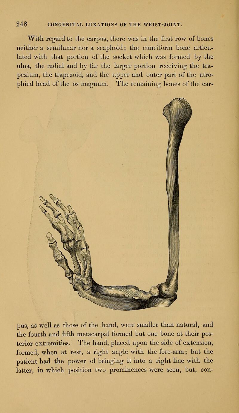 With regard to the carpus, there was in the first row of bones neither a semilunar nor a scaphoid; the cuneiform bone articu- lated with that portion of the socket which was formed by the ulna, the radial and by far the larger portion receiving the tra- pezium, the trapezoid, and the upper and outer part of the atro- phied head of the os magnum. The remaining bones of the car- pus, as well as those of the hand, were smaller than natural, and the fourth and fifth metacarpal formed but one bone at their pos- terior extremities. The hand, placed upon the side of extension, formed, when at rest, a right angle with the fore-arm; but the patient had the power of bringing it into a right line with the latter, in which position two prominences were seen, but, con-
