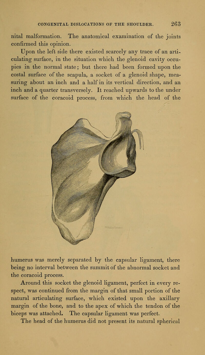 nital malformation. The anatomical examination of the joints confirmed this opinion. Upon the left side there existed scarcely any trace of an arti- culating surface, in the situation which the glenoid cavity occu- pies in the normal state; but there had been formed upon the costal surface of the scapula, a socket of a glenoid shape, mea- suring about an inch and a half in its vertical direction, and an inch and a quarter transversely. It reached upwards to the under surface of the coracoid process, from which the head of the humerus was merely separated by the capsular ligament, there being no interval between the summit of the abnormal socket and the coracoid process. Around this socket the glenoid ligament, perfect in every re- spect, was continued from the margin of that small portion of the natural articulating surface, which existed upon the axillary margin of the bone, and to the apex of which the tendon of the biceps was attached. The capsular ligament was perfect. The head of the humerus did not present its natural spherical