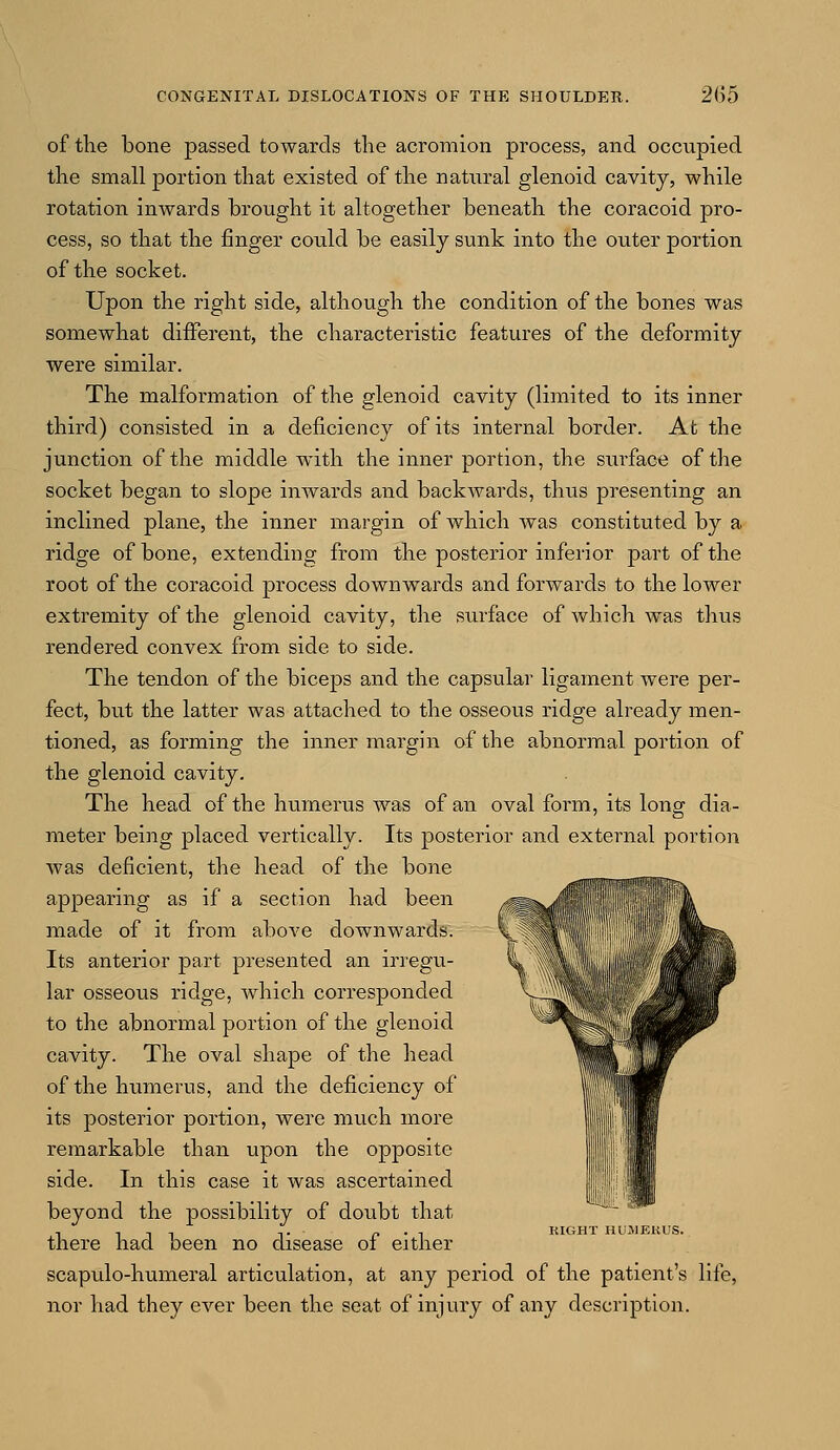 of the bone passed towards the acromion process, and occupied the small portion that existed of the natural glenoid cavity, while rotation inwards brought it altogether beneath the coracoid pro- cess, so that the finger could be easily sunk into the outer portion of the socket. Upon the right side, although the condition of the bones was somewhat different, the characteristic features of the deformity were similar. The malformation of the glenoid cavity (limited to its inner third) consisted in a deficiency of its internal border. At the junction of the middle with the inner portion, the surface of the socket began to slope inwards and backwards, thus presenting an inclined plane, the inner margin of which was constituted by a ridge of bone, extending from the posterior inferior part of the root of the coracoid process downwards and forwards to the lower extremity of the glenoid cavity, the surface of which was thus rendered convex from side to side. The tendon of the biceps and the capsular ligament were per- fect, but the latter was attached to the osseous ridge already men- tioned, as forming the inner margin of the abnormal portion of the glenoid cavity. The head of the humerus was of an oval form, its long dia- meter being placed vertically. Its posterior and external portion was deficient, the head of the bone n _ appearing as if a section had been made of it from above downwards. Its anterior part presented an irregu- lar osseous ridge, which corresponded to the abnormal portion of the glenoid cavity. The oval shape of the head of the humerus, and the deficiency of its posterior portion, were much more remarkable than upon the opposite side. In this case it was ascertained beyond the possibility of doubt that , . KIGHT HUJ1EKUS. there had been no disease oi either scapulo-humeral articulation, at any period of the patient's life, nor had they ever been the seat of injury of any description.