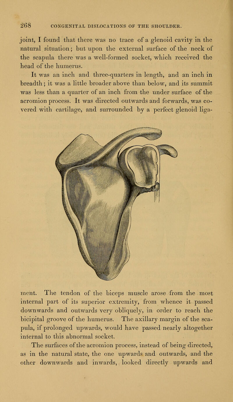 joint, I found that there was no trace of a glenoid cavity in the natural situation; but upon the external surface of the neck of the scapula there was a well-formed socket, which received the head of the humerus. It was an inch and three-quarters in length, and an inch in breadth; it was a little broader above than below, and its summit was less than a quarter of an inch from the under surface of the acromion process. It was directed outwards and forwards, was co- vered with cartilage, and surrounded by a perfect glenoid liga- ment. The tendon of the biceps muscle arose from the most internal part of its superior extremity, from whence it. passed downwards and outwards very obliquely, in order to reach the bicipital groove of the humerus. The axillary margin of the sca- pula, if prolonged upwards, would have passed nearly altogether internal to this abnormal socket. The surfaces of the acromion process, instead of being directed, as in the natural state, the one upwards and outwards, and the other downwards and inwards, looked directly upwards and