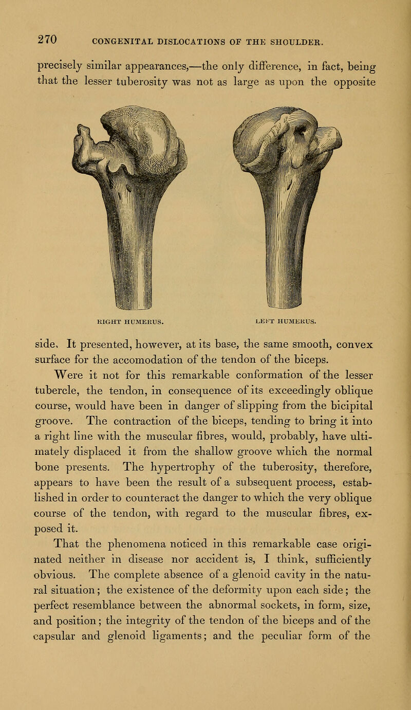 precisely similar appearances,—the only difference, in fact, being that the lesser tuberosity was not as large as upon the opposite RIGHT HUMERUS. LEFT HUMERUS. side, It presented, however, at its base, the same smooth, convex surface for the accomodation of the tendon of the biceps. Were it not for this remarkable conformation of the lesser tubercle, the tendon, in consequence of its exceedingly oblique course, would have been in danger of slipping from the bicipital groove. The contraction of the biceps, tending to bring it into a right line with the muscular fibres, would, probably, have ulti- mately displaced it from the shallow groove which the normal bone presents. The hypertrophy of the tuberosity, therefore, appears to have been the result of a subsequent process, estab- lished in order to counteract the danger to which the very oblique course of the tendon, with regard to the muscular fibres, ex- posed it. That the phenomena noticed in this remarkable case origi- nated neither in disease nor accident is, I think, sufficiently obvious. The complete absence of a glenoid cavity in the natu- ral situation; the existence of the deformity upon each side; the perfect resemblance between the abnormal sockets, in form, size, and position; the integrity of the tendon of the biceps and of the capsular and glenoid ligaments; and the peculiar form of the