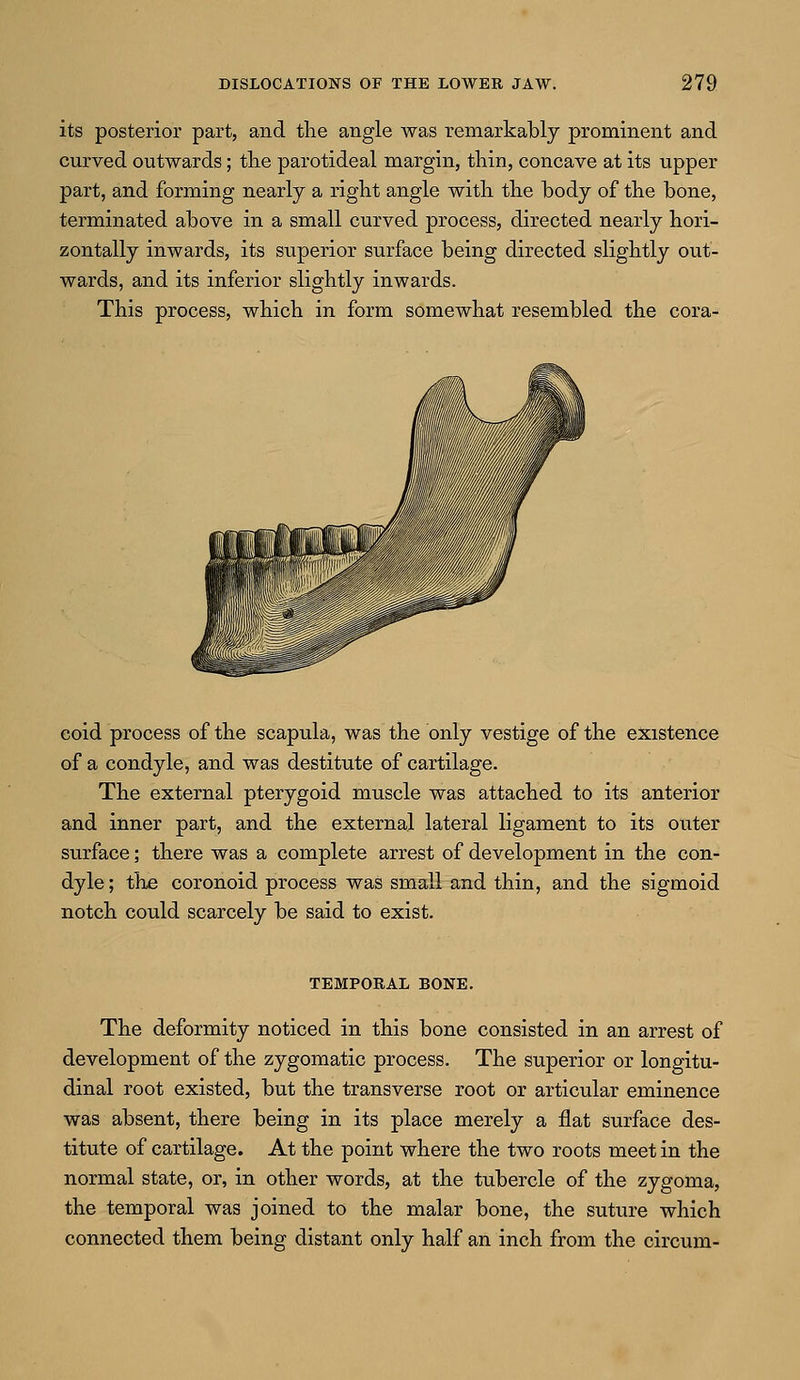 its posterior part, and the angle was remarkably prominent and curved outwards; the parotideal margin, thin, concave at its upper part, and forming nearly a right angle with the body of the bone, terminated above in a small curved process, directed nearly hori- zontally inwards, its superior surface being directed slightly out- wards, and its inferior slightly inwards. This process, which in form somewhat resembled the cora- coid process of the scapula, was the only vestige of the existence of a condyle, and was destitute of cartilage. The external pterygoid muscle was attached to its anterior and inner part, and the external lateral ligament to its outer surface; there was a complete arrest of development in the con- dyle; the coronoid process was small and thin, and the sigmoid notch could scarcely be said to exist. TEMPORAL BONE. The deformity noticed in this bone consisted in an arrest of development of the zygomatic process. The superior or longitu- dinal root existed, but the transverse root or articular eminence was absent, there being in its place merely a flat surface des- titute of cartilage. At the point where the two roots meet in the normal state, or, in other words, at the tubercle of the zygoma, the temporal was joined to the malar bone, the suture which connected them being distant only half an inch from the circum-