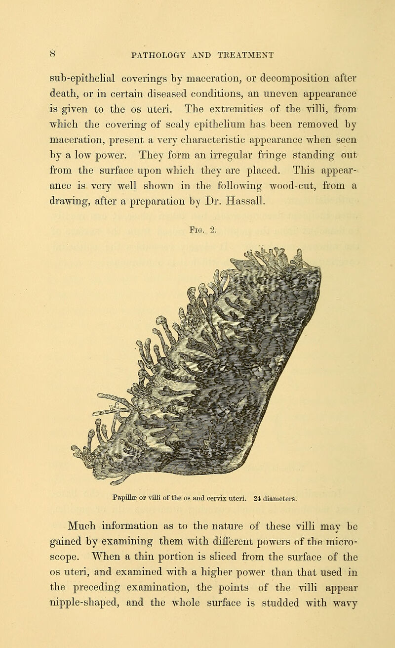 sub-epithelial coverings by maceration, or decomposition after death, or in certain diseased conditions, an uneven appearance is given to the os uteri. The extremities of the villi, from which the covering of scaly epithelium has been removed by maceration, present a very characteristic appearance when seen by a low power. They form an irregular fringe standing out from the surface upon which they are placed. This appear- ance is very well shown in the following wood-cut, from a drawing, after a preparation by Dr. Hassall. Fig. 2. . -. . .-:■- ilr V-*-- ■■ ■'■ »•■. ' ■■■■-.■ wssm Papillae or villi of the os and cervix uteri. 24 diameters. Much information as to the nature of these villi may be gained by examining them with different powers of the micro- scope. When a thin portion is sliced from the surface of the os uteri, and examined with a higher power than that used in the preceding examination, the points of the villi appear nipple-shaped, and the whole surface is studded with wavy