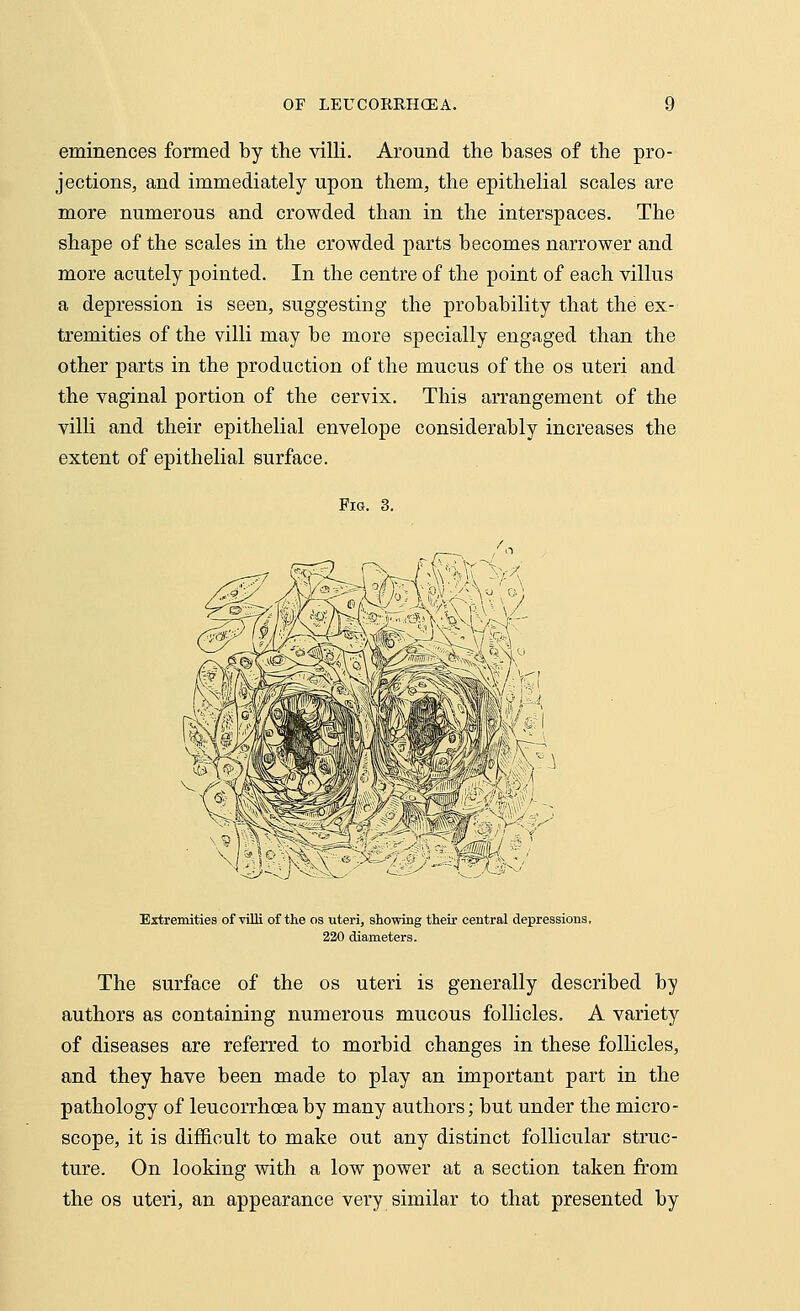 eminences formed by the villi. Around the bases of the pro- jections, and immediately upon them, the epithelial scales are more numerous and crowded than in the interspaces. The shape of the scales in the crowded parts becomes narrower and more acutely pointed. In the centre of the point of each villus a depression is seen, suggesting the probability that the ex- tremities of the villi may be more specially engaged than the other parts in the production of the mucus of the os uteri and the vaginal portion of the cervix. This arrangement of the villi and their epithelial envelope considerably increases the extent of epithelial surface. Fig. 3. Extremities of villi of the os uteri, showing their central depressions. 220 diameters. The surface of the os uteri is generally described by authors as containing numerous mucous follicles. A variety of diseases are referred to morbid changes in these follicles, and they have been made to play an important part in the pathology of leucorrhoea by many authors; but under the micro- scope, it is difficult to make out any distinct follicular struc- ture. On looking with a low power at a section taken from the os uteri, an appearance very similar to that presented by