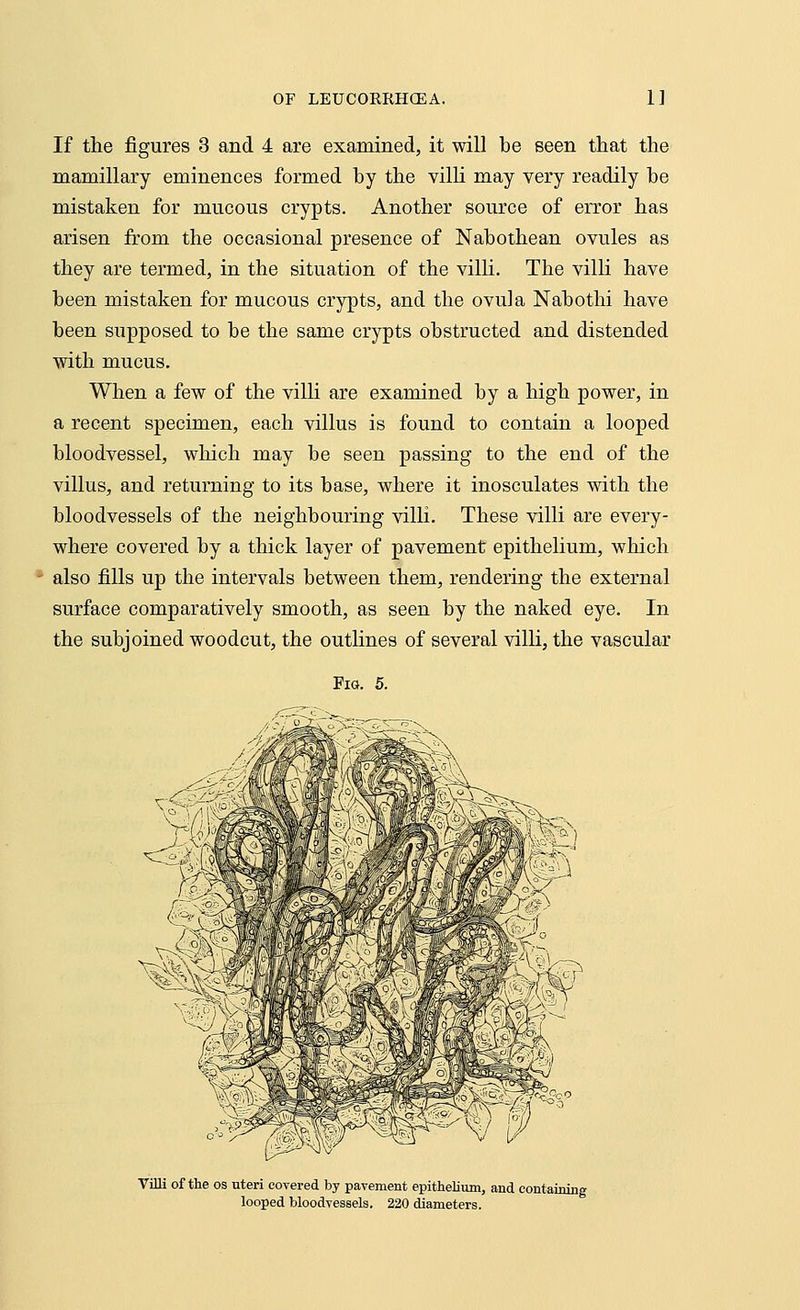 If the figures 3 and 4 are examined, it will be seen that the mamillary eminences formed by the villi may very readily be mistaken for mucous crypts. Another source of error has arisen from the occasional presence of Nabothean ovules as they are termed, in the situation of the villi. The villi have been mistaken for mucous crypts, and the ovula Nabothi have been supposed to be the same crypts obstructed and distended with mucus. When a few of the villi are examined by a high power, in a recent specimen, each villus is found to contain a looped bloodvessel, which may be seen passing to the end of the villus, and returning to its base, where it inosculates with the bloodvessels of the neighbouring villi. These villi are every- where covered by a thick layer of pavement epithelium, which also fills up the intervals between them, rendering the external surface comparatively smooth, as seen by the naked eye. In the subjoined woodcut, the outlines of several villi, the vascular Fig. 5. *-f? Villi of the os uteri covered by pavement epithelium, and containing looped bloodvessels. 220 diameters.