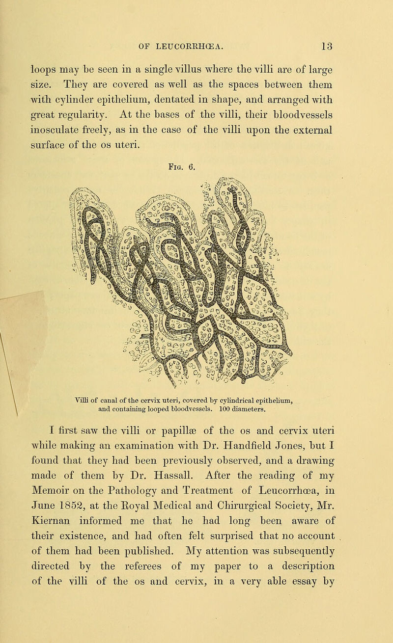 loops may be seen in a single villus where the villi are of large size. They are covered as well as the spaces between them with cylinder epithelium, dentated in shape, and arranged with great regularity. At the bases of the villi, their bloodvessels inosculate freely, as in the case of the villi upon the external surface of the os uteri. Fig. 6. Villi of canal of the cervix uteri, covered by cylindrical epithelium, and containing looped bloodvessels. 100 diameters. I first saw the villi or papillae of the os and cervix uteri while making an examination with Dr. Handheld Jones, but I found that they had been previously observed, and a drawing made of them by Dr. Hassall. After the reading of my Memoir on the Pathology and Treatment of Leucorrhcea, in June 1852, at the Eoyal Medical and Chirurgical Society, Mr. Kiernan informed me that he had long been aware of their existence, and had often felt surprised that no account of them had been published. My attention was subsequently directed by the referees of my paper to a description of the villi of the os and cervix, in a very able essay by