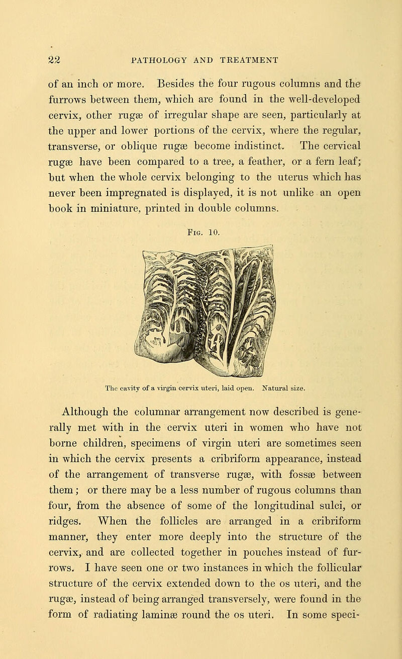 of an inch or more. Besides the four rugous columns and the furrows hetween them, which are found in the well-developed cervix, other ragse of irregular shape are seen, particularly at the upper and lower portions of the cervix, where the regular, transverse, or oblique rugae hecome indistinct. The cervical rugse have heen compared to a tree, a feather, or a fern leaf; hut when the whole cervix belonging to the uterus which has never been impregnated is displayed, it is not unlike an open hook in miniature, printed in double columns. Fig. 10. The cavity of a virgin cervix uteri, laid open. Natural size. Although the columnar arrangement now described is gene- rally met with in the cervix uteri in women who have not borne children, specimens of virgin uteri are sometimes seen in which the cervix presents a cribriform appearance, instead of the arrangement of transverse rugse, with fossse between them; or there may be a less number of rugous columns than four, from the absence of some of the longitudinal sulci, or ridges. When the follicles are arranged in a cribriform manner, they enter more deeply into the structure of the cervix, and are collected together in pouches instead of fur- rows. I have seen one or two instances in which the follicular structure of the cervix extended down to the os uteri, and the rugse, instead of being arranged transversely, were found in the form of radiating laminse round the os uteri. In some speci-