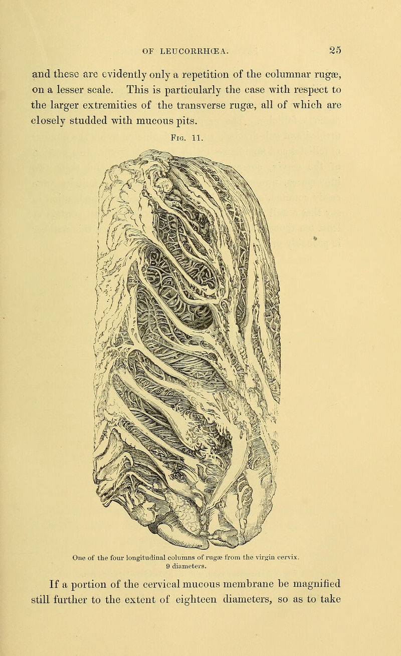 and these are evidently only a repetition of the columnar rugae, on a lesser scale. This is particularly the case with respect to the larger extremities of the transverse ruga?, all of which are closely studded with mucous pits. Fig. 11. One of the four longitudinal columns of rugae from the virgin cervix. 9 diameters. If a portion of the cervical mucous membrane be magnified still further to the extent of eighteen diameters, so as to take