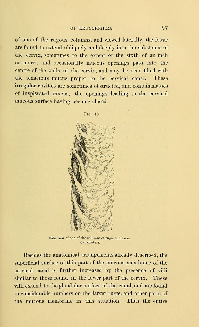 of one of the rugous columns, and viewed laterally, the fossa? are found to extend obliquely and deeply into the substance of the cervix, sometimes to the extent of the sixth of an inch or more; and occasionally mucous openings pass into the centre of the walls of the cervix, and may be seen filled with the tenacious mucus proper to the cervical canal. These irregular cavities are sometimes obstructed, and contain masses of inspissated mucus, the openings leading to the cervical mucous surface having become closed. Fig. 13. '■<tsfj „'•'/ tIs/1 y?4 Side view of one of the columns of rugae and fossae. 6 diameters. Besides the anatomical arrangements already described, the superficial surface of this part of the mucous membrane of the cervical canal is further increased by the presence of villi similar to those found in the lower part of the cervix. These villi extend to the glandular surface of the canal, and are found in considerable numbers on the larger ruga?, and other parts of the mucous membrane in this situation. Thus the entire