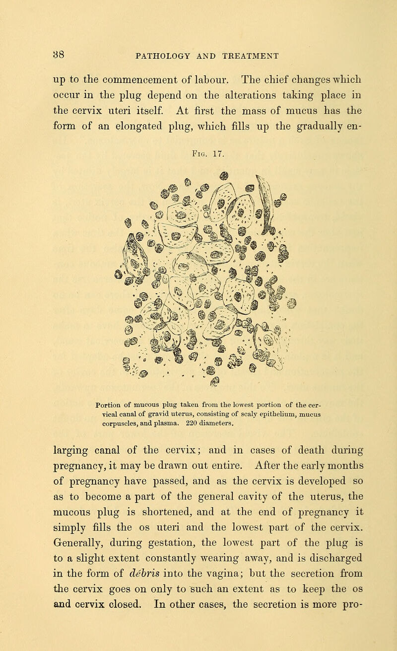 98 up to the commencement of labour. The chief changes which occur in the plug depend on the alterations taking place in the cervix uteri itself. At first the mass of mucus has the form of an elongated plug, which fills up the gradually en- Fig. 17. Portion of mucous plug taken from the lowest portion of the cer- vical canal of gravid uterus, consisting of scaly epithelium, mucus corpuscles, and plasma. 220 diameters. larging canal of the cervix; and in cases of death during pregnancy, it may be drawn out entire. After the early months of pregnancy have passed, and as the cervix is developed so as to become a part of the general cavity of the uterus, the mucous plug is shortened, and at the end of pregnancy it simply fills the os uteri and the lowest part of the cervix. Generally, during gestation, the lowest part of the plug is to a slight extent constantly wearing away, and is discharged in the form of debris into the vagina; but the secretion from the cervix goes on only to ^uch an extent as to keep the os and cervix closed. In other cases, the secretion is more pro-