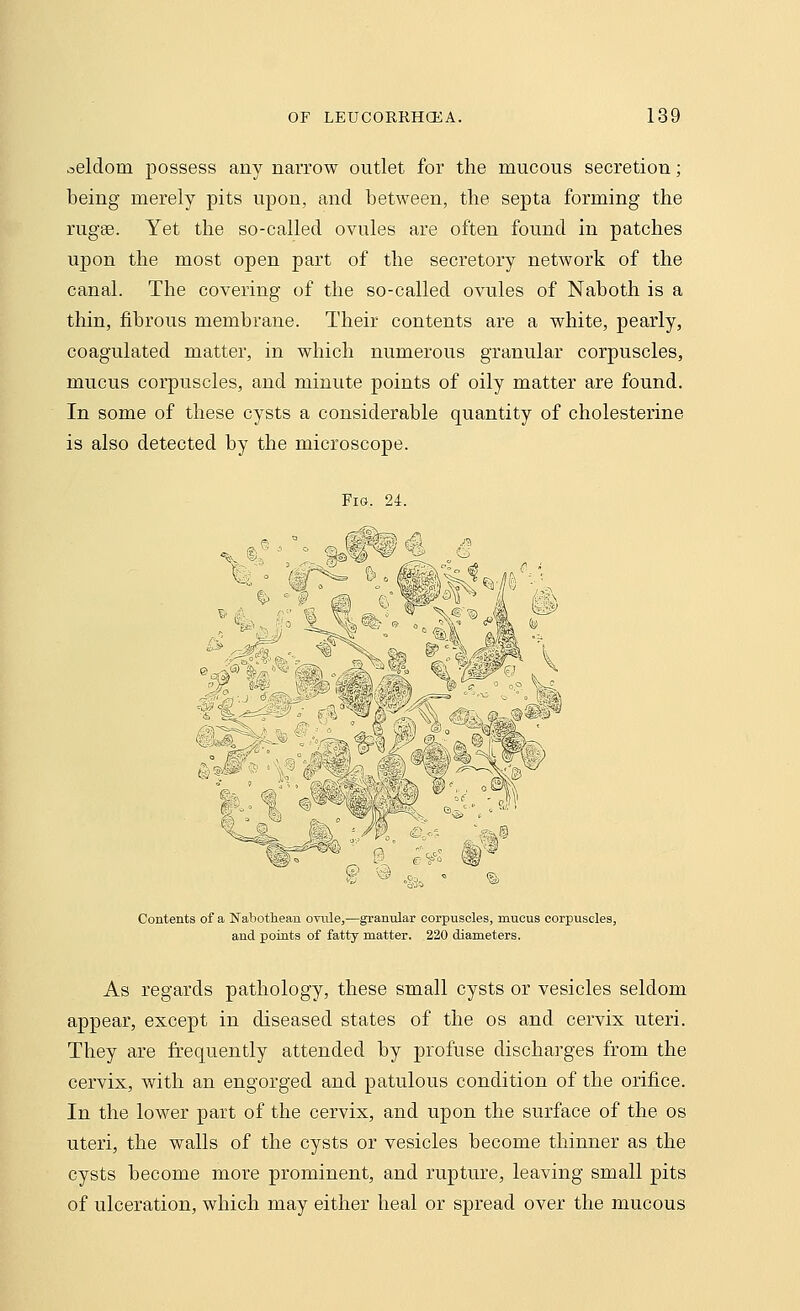 seldom possess any narrow outlet for the mucous secretion; being merely pits upon, and between, the septa forming the rugse. Yet the so-called ovules are often found in patches upon the most open part of the secretory network of the canal. The covering of the so-called ovules of Naboth is a thin, fibrous membrane. Their contents are a white, pearly, coagulated matter, in which numerous granular corpuscles, mucus corpuscles, and minute points of oily matter are found. In some of these cysts a considerable quantity of cholesterine is also detected by the microscope. Fig. 24. Contents of a Xabothean ovule,—granular corpuscles, mucus corpuscles, and points of fatty matter. 220 diameters. As regards pathology, these small cysts or vesicles seldom appear, except in diseased states of the os and cervix uteri. They are frequently attended by profuse discharges from the cervix, with an engorged and patulous condition of the orifice. In the lower part of the cervix, and upon the surface of the os uteri, the walls of the cysts or vesicles become thinner as the cysts become more prominent, and rupture, leaving small pits of ulceration, which may either heal or spread over the mucous