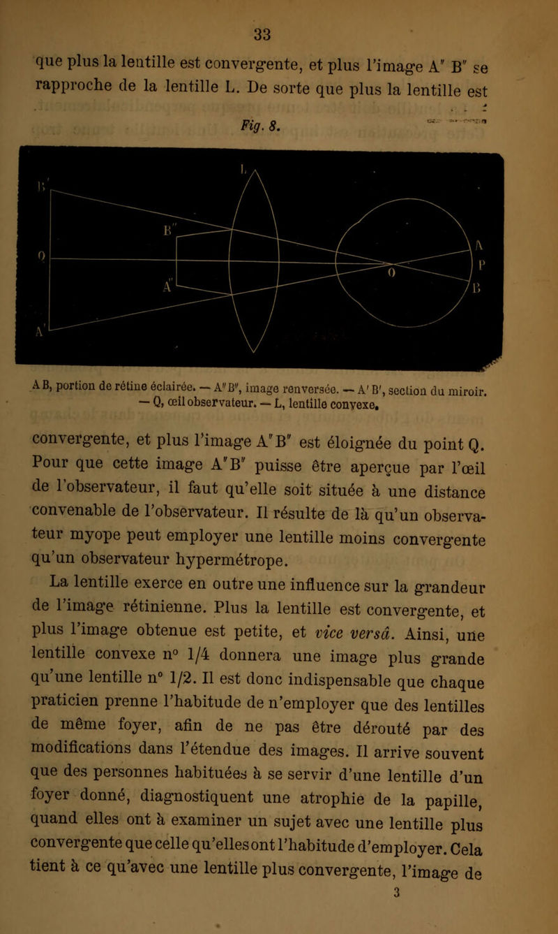 que plus la lentille est convergente, et plus l'image A B se rapproche de la lentille L. De sorte que plus la lentille est h 8. AB, portion de rétine éclairée. - A»B, image renversée. - A' B', section du miroir. — Q, œil observateur. — L, lentille conyexe. convergente, et plus l'image AB est éloignée du point Q. Pour que cette image AB puisse être aperçue par l'œil de l'observateur, il faut qu'elle soit située à une distance convenable de l'observateur. Il résulte de là qu'un observa- teur myope peut employer une lentille moins convergente qu'un observateur hypermétrope. La lentille exerce en outre une influence sur la grandeur de l'image rétinienne. Plus la lentille est convergente, et plus l'image obtenue est petite, et vice versa. Ainsi, une lentille convexe n° 1/4 donnera une image plus grande qu'une lentille n° 1/2. Il est donc indispensable que chaque praticien prenne l'habitude de n'employer que des lentilles de même foyer, afin de ne pas être dérouté par des modifications dans l'étendue des images. Il arrive souvent que des personnes habituées à se servir d'une lentille d'un foyer donné, diagnostiquent une atrophie de la papille, quand elles ont à examiner un sujet avec une lentille plus convergente que celle qu'elles ont l'habitude d'employer. Cela tient à ce qu'avec une lentille plus convergente, l'image de 3