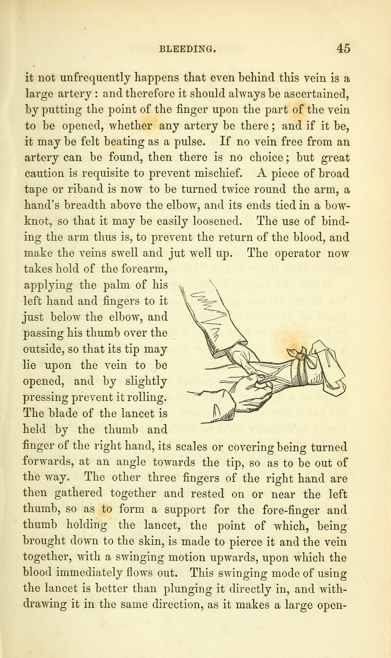 it not unfrequently happens that even behind this vein is a large artery : and therefore it should always be ascertained, by putting the point of the finger upon the part of the vein to be opened, whether any artery be there; and if it be, it may be felt beating as a pulse. If no vein free from an artery can be found, then there is no choice; but great caution is requisite to prevent mischief. A piece of broad tape or riband is now to be turned twice round the arm, a hand's breadth above the elbow, and its ends tied in a bow- knot, so that it may be easily loosened. The use of bind- ing the arm thus is, to prevent the return of the blood, and make the veins swell and jut well up. The operator now takes hold of the forearm, applying the palm of his left hand and fingers to it just below the elbow, and passing his thumb over the outside, so that its tip may lie upon the vein to be opened, and by slightly pressing prevent it rolling. The blade of the lancet is held by the thumb and finger of the right hand, its scales or covering being turned forwards, at an angle towards the tip, so as to be out of the way. The other three fingers of the right hand are then gathered together and rested on or near the left thumb, so as to form a support for the fore-finger and thumb holding the lancet, the point of which, being brought down to the skin, is made to pierce it and the vein together, with a swinging motion upwards, upon which the blood immediately flows out. This swinging mode of using the lancet is better than plunging it directly in, and with- drawing it in the same direction, as it makes a large open-