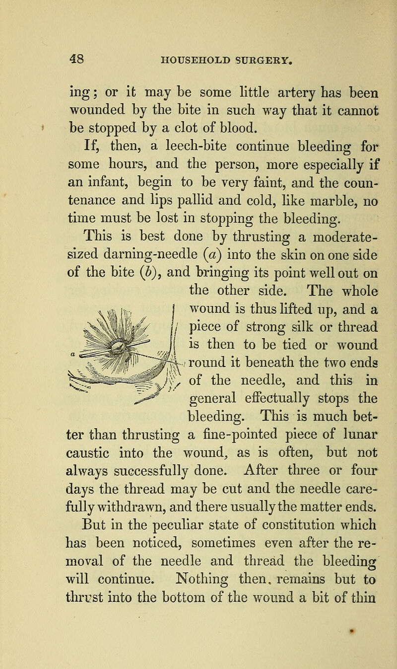 ing; or it may be some little artery has been wounded by the bite in such way that it cannot be stopped by a clot of blood. If, then, a leech-bite continue bleeding for some hours, and the person, more especially if an infant, begin to be very faint, and the coun- tenance and lips pallid and cold, like marble, no time must be lost in stopping the bleeding. This is best done by thrusting a moderate- sized darning-needle (a) into the skin on one side of the bite (Z»), and bringing its point well out on the other side. The whole wound is thus lifted up, and a piece of strong silk or thread is then to be tied or wound round it beneath the two ends of the needle, and this in general effectually stops the bleeding. This is much bet- ter than thrusting a fine-pointed piece of lunar caustic into the wound, as is often, but not always successfully done. After three or four days the thread may be cut and the needle care- fully withdrawn, and there usually the matter ends. But in the peculiar state of constitution which has been noticed, sometimes even after the re- moval of the needle and thread the bleeding will continue. Nothing then, remains but to thrust into the bottom of the wound a bit of thin