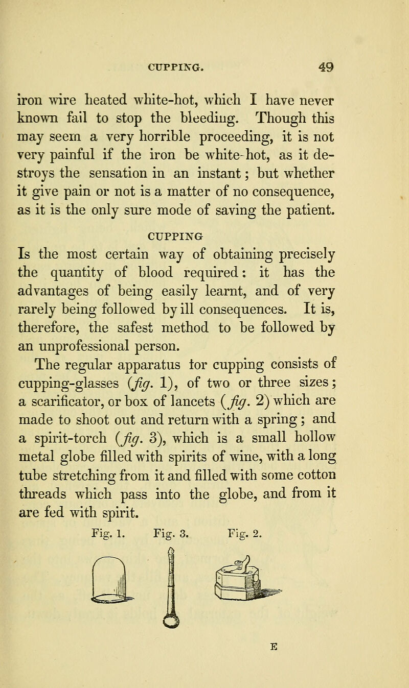 iron wire heated white-hot, which I have never known fail to stop the bleeding. Though this may seem a very horrible proceeding, it is not very painful if the iron be white-hot, as it de- stroys the sensation in an instant; but whether it give pain or not is a matter of no consequence, as it is the only sure mode of saving the patient. cupping Is the most certain way of obtaining precisely the quantity of blood required: it has the advantages of being easily learnt, and of very rarely being followed by ill consequences. It is, therefore, the safest method to be followed by an unprofessional person. The regular apparatus tor cupping consists of cupping-glasses {Jig. 1), of two or three sizes; a scarificator, or box of lancets {fig. 2) which are made to shoot out and return with a spring; and a spirit-torch {fig. 3), which is a small hollow metal globe filled with spirits of wine, with a long tube stretching from it and filled with some cotton threads which pass into the globe, and from it are fed with spirit. Fig. 1. Fig. 3. Fig. 2. 6