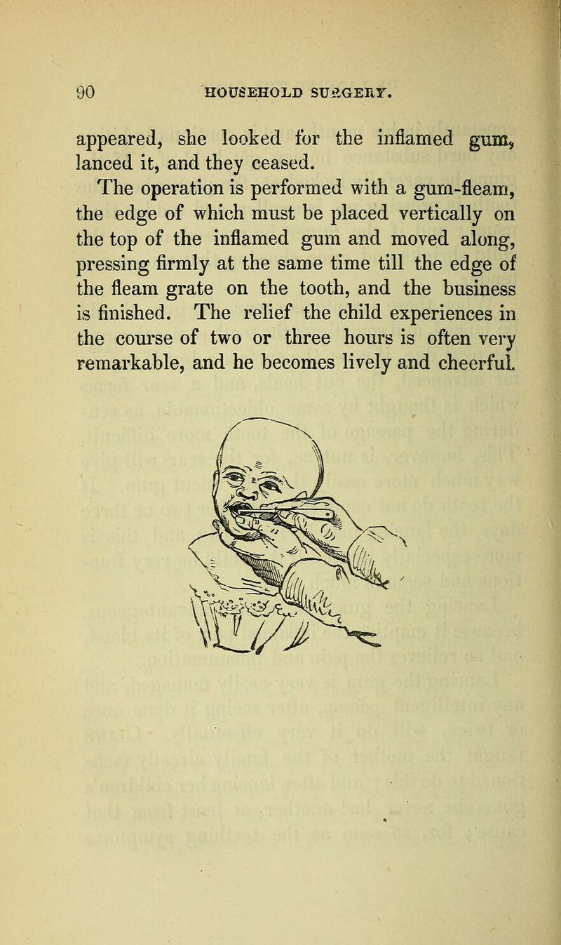 appeared, she looked for the inflamed gum, lanced it, and they ceased. The operation is performed with a gurn-fleam, the edge of which must be placed vertically on the top of the inflamed gum and moved along, pressing firmly at the same time till the edge of the fleam grate on the tooth, and the business is finished. The relief the child experiences in the course of two or three hours is often very remarkable, and he becomes lively and cheerful. * >