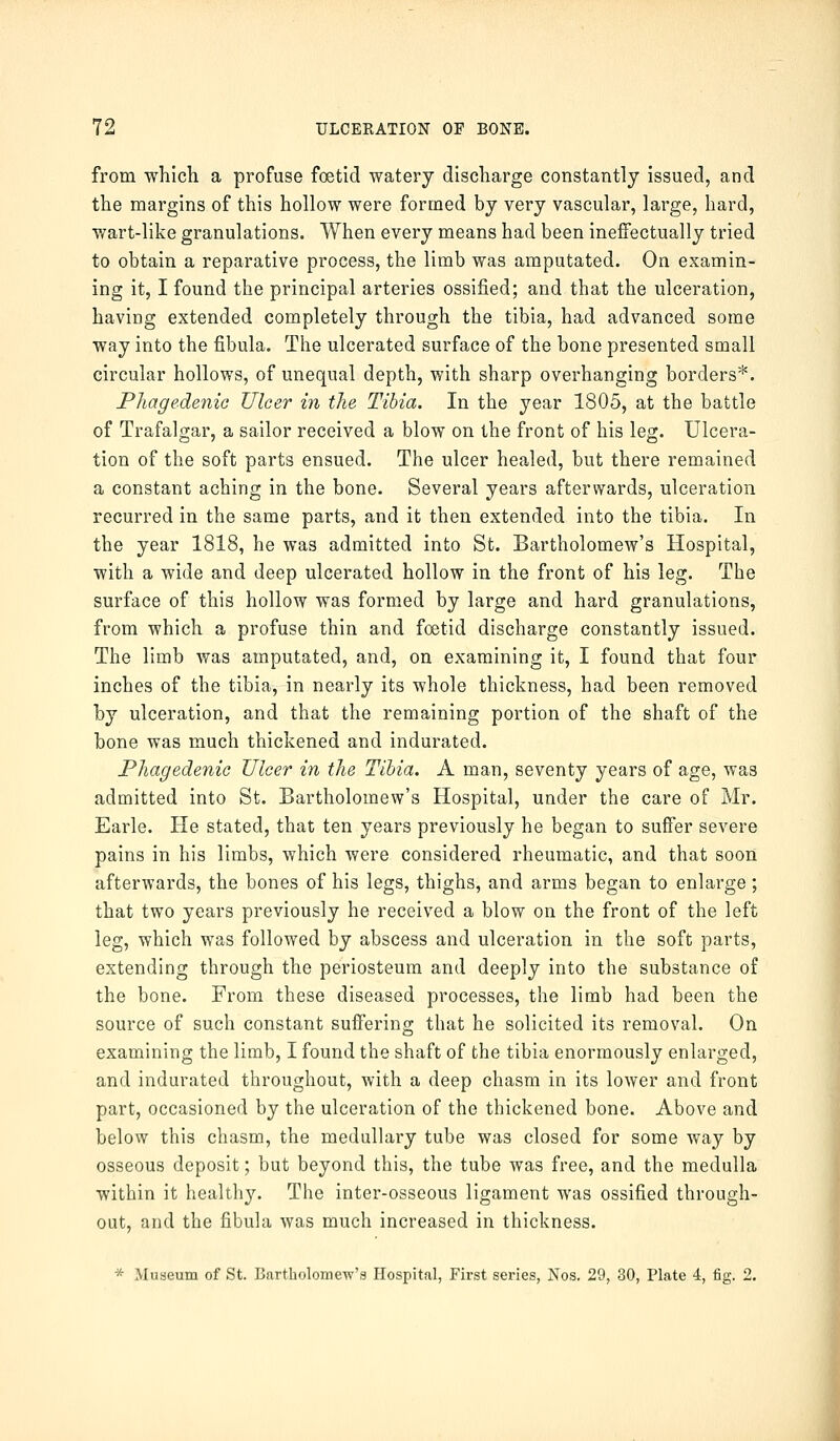 from which a profuse foetid watery discharge constantly issued, and the margins of this hollow were formed by very vascular, large, hard, wart-like granulations. When every means had been ineffectually tried to obtain a reparative process, the limb was amputated. On examin- ing it, I found the principal arteries ossified; and that the ulceration, having extended completely through the tibia, had advanced some way into the fibula. The ulcerated surface of the bone presented small circular hollows, of unequal depth, with sharp overhanging borders*. Phagedenic Ulcer in the Tibia. In the year 1805, at the battle of Trafalgar, a sailor received a blow on the front of his leg. Ulcera- tion of the soft parts ensued. The ulcer healed, but there remained a constant aching in the bone. Several years afterwards, ulceration recurred in the same parts, and it then extended into the tibia. In the year 1818, he was admitted into St. Bartholomew's Hospital, with a wide and deep ulcerated hollow in the front of his leg. The surface of this hollow was formed by large and hard granulations, from which a profuse thin and foetid discharge constantly issued. The limb was amputated, and, on examining it, I found that four inches of the tibia, in nearly its whole thickness, had been removed by ulceration, and that the remaining portion of the shaft of the bone was much thickened and indurated. Phagedenic Ulcer in the Tibia. A man, seventy years of age, was admitted into St. Bartholomew's Hospital, under the care of Mr. Earle. He stated, that ten years previously he began to suffer severe pains in his limbs, which were considered rheumatic, and that soon afterwards, the bones of his legs, thighs, and arms began to enlarge; that two years previously he received a blow on the front of the left leg, which was followed by abscess and ulceration in the soft parts, extending through the periosteum and deeply into the substance of the bone. From these diseased processes, the limb had been the source of such constant suffering that he solicited its removal. On examining the limb, I found the shaft of the tibia enormously enlarged, and indurated throughout, with a deep chasm in its lower and front part, occasioned by the ulceration of the thickened bone. Above and below this chasm, the medullary tube was closed for some way by osseous deposit; but beyond this, the tube was free, and the medulla within it healthy. The inter-osseous ligament was ossified through- out, and the fibula was much increased in thickness. * Museum of St. Bartholomew's Hospital, First series, Nos. 29, 30, Plate 4, fig. 2.