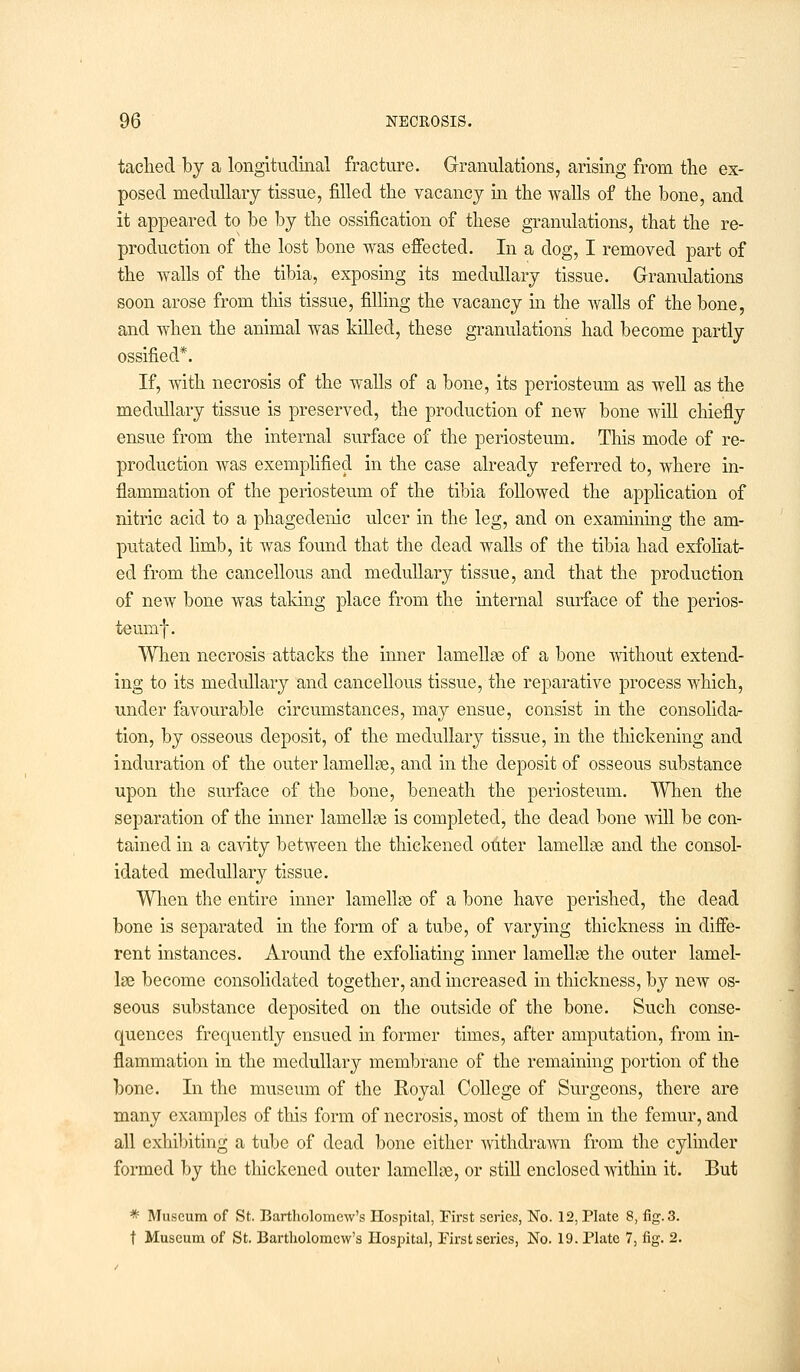 tached by a longitudinal fracture. Granulations, arising from the ex- posed medullary tissue, filled the vacancy in the walls of the bone, and it appeared to be by the ossification of these granulations, that the re- production of the lost bone was effected. In a dog, I removed part of the walls of the tibia, exposing its medullary tissue. Granulations soon arose from this tissue, filling the vacancy in the walls of the bone, and when the animal was killed, these granulations had become partly ossified*. If, with necrosis of the walls of a bone, its periosteum as well as the medullary tissue is preserved, the production of new bone will chiefly ensue from the internal surface of the periosteum. This mode of re- production was exemplified in the case already referred to, where in- flammation of the periosteum of the tibia followed the application of nitric acid to a phagedenic ulcer in the leg, and on examining the am- putated limb, it was found that the dead walls of the tibia had exfoliat- ed from the cancellous and medullary tissue, and that the production of new bone was taking place from the internal surface of the perios- teumf. When necrosis attacks the inner lamellae of a bone without extend- ing to its medullary and cancellous tissue, the reparative process which, under favourable circumstances, may ensue, consist in the consolida- tion, by osseous deposit, of the medullary tissue, in the thickening and induration of the outer lamellae, and in the deposit of osseous substance upon the surface of the bone, beneath the periosteum. When the separation of the inner lamellae is completed, the dead bone will be con- tained in a cavity between the thickened outer lamellae and the consol- idated medullary tissue. When the entire inner lamella of a bone have perished, the dead bone is separated in the form of a tube, of varying thickness in diffe- rent instances. Around the exfoliating inner lamellae the outer lamel- lae become consolidated together, and increased in thickness, by new os- seous substance deposited on the outside of the bone. Such conse- quences frequently ensued in former times, after amputation, from in- flammation in the medullary membrane of the remaining portion of the bone. In the museum of the Royal College of Surgeons, there are many examples of this form of necrosis, most of them in the femur, and all exhibiting a tube of dead bone either withdrawn from the cylinder formed by the thickened outer lamellae, or still enclosed within it. But * Museum of St. Bartholomew's Hospital, First series, No. 12, Plate 8, fig. 3. t Museum of St. Bartholomew's Hospital, First series, No. 19. Plate 7, fig. 2.