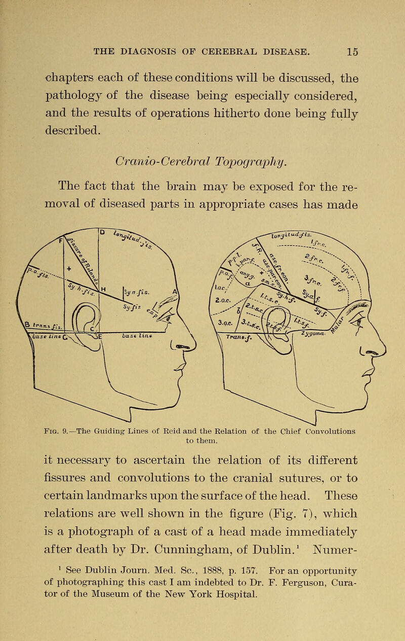 chapters each of these conditions will be discussed, the pathology of the disease being especially considered, and the results of operations hitherto done being fully described. Cranio-Cerebral Topography. The fact that the brain may be exjDosed for the re- moval of diseased parts in appropriate cases has made Fig. 9.—The Guiding Lines of Reid and the Relation of the Chief Convolutions to them. it necessary to ascertain the relation of its different fissures and convolutions to the cranial sutures, or to certain landmarks upon the surface of the head. These relations are well shown in the figure (Fig. Y), which is a photograph of a cast of a head made immediately after death by Dr. Cunningham, of Dublin.1 Numer- 1 See Dublin Journ. Med. So., 1888, p. 157. For an opportunity of photographing this cast I am indebted to Dr. F. Ferguson, Cura- tor of the Museum of the New York Hospital.