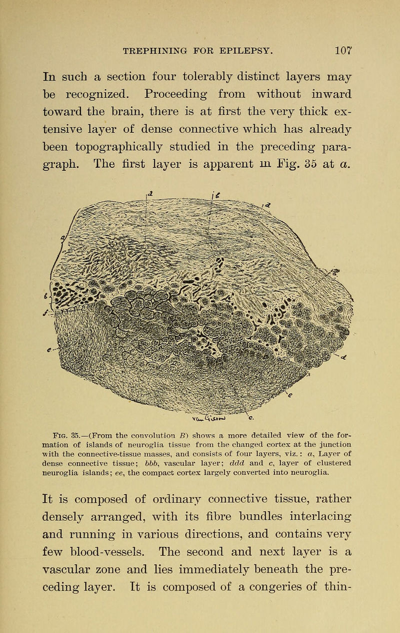 In such a section four tolerably distinct layers may be recognized. Proceeding from without inward toward the brain, there is at first the very thick ex- tensive layer of dense connective which has already been topographically studied in the preceding para- graph. The first layer is apparent in Fig. 35 at a. T^C'Jji'^ Fig. 35.—(From the convolution B) shows a more detailed view of the for- mation of islands of neuroglia tissue from the changed cortex at the junction with the connective-tissue masses, and consists of four layers, viz.: a, Layer of dense connective tissue; bbb, vascular layer; ddd and c, layer of clustered neuroglia islands; ee, the compact cortex largely converted into neuroglia. It is composed of ordinary connective tissue, rather densely arranged, with its fibre bundles interlacing and running in various directions, and contains very few blood-vessels. The second and next layer is a vascular zone and lies immediately beneath the pre- ceding layer. It is composed of a congeries of thin-