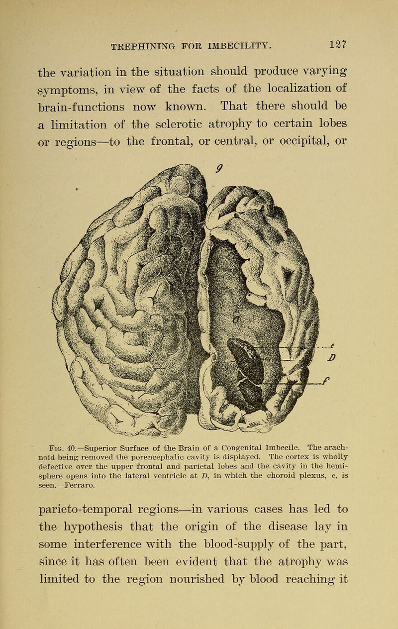 the variation in the situation should produce varying symptoms, in view of the facts of the localization of brain-functions now known. That there should be a limitation of the sclerotic atrophy to certain lobes or regions—to the frontal, or central, or occipital, or Fig. 40.—Superior Surface of the Brain of a Congenital Imbecile. The arach- noid being removed the porencephalic cavity is displayed. The cortex is wholly defective over the upper frontal and parietal lobes and the cavity in the hemi- sphere opens into the lateral ventricle at D, in which the choroid plexus, e, is seen.—Ferra.ro. parieto-temporal regions—in various cases has led to the hypothesis that the origin of the disease lay in some interference with the blood-supply of the part, since it has often been evident that the atrophy was limited to the region nourished by blood reaching it