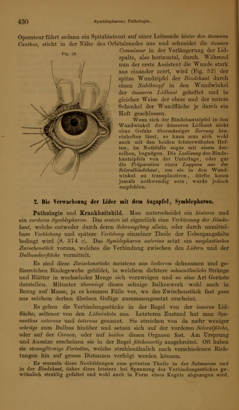 Fig. Operateur fuhrt sodann ein Spitzbistouri auf einer Leitsonde hinter den äusseren Cardhus, sticht in der Xähe des Orbitalrandes aus und schneidet die äussere Commissur in der Verlängerung der Lid- spalte, also horizontal, durch. Während nun der erste Assistent die Wunde stark aus einander zerrt, wird (Fig. 52) der spitze Wundzipfel der Bindehaut durch einen Nahtknopf in den Wundwinkel der äusseren Lidhaut geheftet und in gleicher Weise der obere und der untere Schenkel der Wundiläche je durch ein Heft geschlossen. Wenn sich der Bindehautzipfel in den Wundwinkel der äusseren Lidhaut nicht ohne Gefahr übermässiger Zerrung hin- einheften lässt, so kann man sich wohl auch mit den beiden letzterwähnten Hef- ten, im Nothfalle sogar mit einem der- selben, begnügen. Die Loslösung des Binde- hautzipfels von der Unterlage, oder gar die Präparation eines Lappens aus der Scleralbindehaut, um sie in den Wund- winkel zu transplantiren, dürfte kaum jemals nothwendig sein , wurde jedoch empfohlen. 2. Die Verwachsung der Lider mit dem Augapfel; Symblepharon. Pathologie und Krankheitsbild. Man unterscheidet ein hinteres und ein vorderes Symblepharon. Das erstere ist eigentlich eine Verkürzung der Binde- haut, welche entweder durch deren Schrumpfung allein, oder durch unmittel- bare Verklebung und spätere Verödung einzelner Theile der Uebergangsfalte bedingt wird (S. 374 c). Das Symblepharon anterius setzt ein neoplastisches Zwischenstück voraus, welches die Verbindung zwischen den Lidern und der Bulbusoberfläche vermittelt. Es sind diese Zwischenstücke meistens aus lockerem dehnsamen und ge- fässreichen Bindegewebe gebildet, in welchem dichtere sehnenähnliche Stränge und Blätter in wechselnder Menge sich verzweigen und so eine Art Gerüste darstellen. Mitunter überwiegt dieses sehnige Balkenwerk wohl auch in Bezug auf Masse, ja es kommen Fälle vor, wo das Zwischenstück fast ganz aus solchem derben fibrösen Gefüge zusammengesetzt erscheint, Es gehen die Verbindungsstücke in der Regel von der inneren Lid- fläche, seltener von den Lidwinkeln aus. Letzteren Zustand hat man Syn- canthus externus und internus genannt. Sie streichen von da mehr weniger schräge zum Bulbus hinüber und setzen sich auf der vorderen Scleralfläche, oder auf der Cornea, oder auf beiden diesen Organen fest. Am Ursprung und Ansätze erscheinen sie in der Regel flächenartig ausgebreitet. Oft haben sie strangförmige Fortsätze, welche strahlenähnlich nach verschiedenen Rich- tungen hin auf grosse Distanzen verfolgt werden können. Es wurzeln diese Neubildungen zum grössten Theile in der Submucosa und in der Bindehaut, daher diese letztere bei Spannung des Verbindungsstückes ge- wöhnlich strahlig gefaltet und wohl auch in Form eines Kegels abgezogen wird.