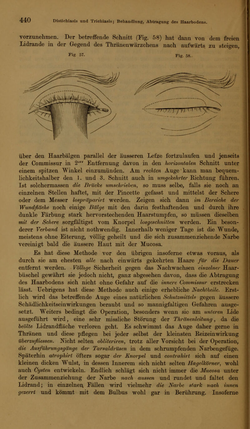 vorzunehmen. Der betreffende Schnitt (Fig. 58) hat dann von dem freien Lidrande in der Gegend des Thränenwärzchens nach aufwärts zu steigen, FiS 57. Fig. 58. - yp)ßßi.}, fjn\ 4 \T^V* \^^ über den Haarbälgen parallel der äusseren Lefze fortzulaufen und jenseits der Commissur in 2' Entfernung davon in den horizontalen Schnitt unter einem spitzen Winkel einzumünden. Am rechten Auge kann man bequem- lichkeitshalber den 1. und 3. Schnitt auch in umgekehrter Richtung führen. Ist solchermassen die Brücke umschrieben, so muss selbe, falls sie noch an einzelnen Stellen haftet, mit der Pincette gefasst und mittelst der Schere oder dem Messer lospräparirt werden. Zeigen sich dann im Bereiche der Wundfläche noch einige Bälge mit den darin festhaftenden und durch ihre dunkle Färbung stark hervorstechenden Haarstumpfen, so müssen dieselben mit der Schere sorgfältigst vom Knorpel los geschnitten werden. Ein beson- derer Verband ist nicht nothwendig. Innerhalb weniger Tage ist die Wunde, meistens ohne Eiterung, völlig geheilt und die sich zusammenziehende Narbe vereinigt bald die äussere Haut mit der Mucosa. Es hat diese Methode vor den übrigen insoferne etwas voraus, als durch sie am ehesten alle nach einwärts gekehrten Haare für die Dauer entfernt werden. Völlige Sicherheit gegen das Kachwachsen einzelner Haar- büschel gewährt sie jedoch nicht, ganz abgesehen davon, dass die Abtragung des Haarbodens sich nicht ohne Gefahr auf die innere Commissur erstrecken lässt. Uebrigens hat diese Methode auch einige erhebliche Nachtheile. Erst- lich wird das betreffende Auge eines natürlichen Schutzmittels gegen äussere Schädlichkeitseinwirkungen beraubt und so mannigfaltigen Gefahren ausge- setzt. Weiters bedingt die Operation, besonders wenn sie am unteren Lide ausgeführt wird, eine sehr missliche Störung der Thränenleitung, da die beölte Lidrandfläche verloren geht. Es schwimmt das Auge daher gerne in Thränen und diese pflegen bei jeder selbst der kleinsten Reizeinwirkung überzufliessen. Nicht selten obliteriren, trotz aller Vorsicht bei der Operation, die Ausführungsgänge der Tarsaldrüsen in dem schrumpfenden Narbengefüge. Späterhin atrophirt öfters sogar der Knorpel und contrahirt sich auf einen kleinen dicken Wulst, in dessen Innerem sich nicht selten Hagelkörner, wohl auch Cysten entwickeln. Endlich schlägt sich nicht immer die Mucosa unter der Zusammenziehung der Narbe nach aussen und rundet und faltet den Lidrand; in einzelner; Fällen wird vielmehr die Narbe stark nach innen gezerrt und kömmt mit dem Bulbus wohl gar in Berührung. Insoferne