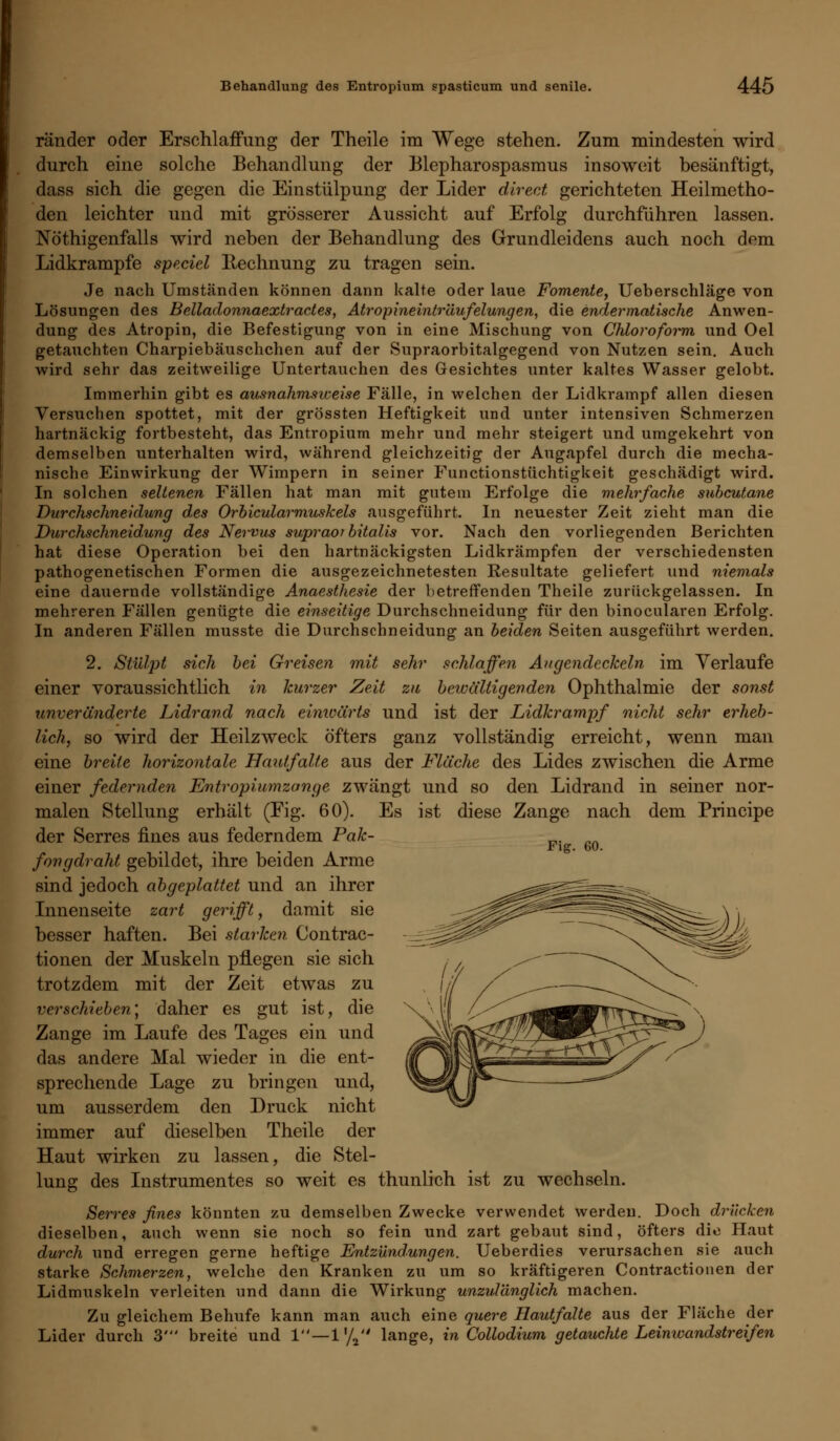 ränder oder Erschlaffung der Theile im Wege stehen. Zum mindesten wird durch eine solche Behandlung der Blepharospasmus insoweit besänftigt, dass sich die gegen die Einstülpung der Lider direct gerichteten Heilmetho- den leichter und mit grösserer Aussicht auf Erfolg durchführen lassen. Nötigenfalls wird neben der Behandlung des Grundleidens auch noch dem Lidkrampfe speciel Itechnung zu tragen sein. Je nach Umständen können dann kalte oder laue Fomente, Ueberschläge von Lösungen des Belladonnaextractes, Atropineinträufeiungen, die endermatische Anwen- dung des Atropin, die Befestigung von in eine Mischung von Chloroform und Oel getauchten Charpiebäuschchen auf der Supraorbitalgegend von Nutzen sein. Auch wird sehr das zeitweilige Untertauchen des Gesichtes unter kaltes Wasser gelobt. Immerhin gibt es ausnahmsweise Fälle, in welchen der Lidkrampf allen diesen Versuchen spottet, mit der grössten Heftigkeit und unter intensiven Schmerzen hartnäckig fortbesteht, das Entropium mehr und mehr steigert und umgekehrt von demselben unterhalten wird, während gleichzeitig der Augapfel durch die mecha- nische Einwirkung der Wimpern in seiner Functionstüchtigkeit geschädigt wird. In solchen seltenen Fällen hat man mit gutem Erfolge die mehrfache subcutane Durchschneidung des Orbicularmuskels ausgeführt. In neuester Zeit zieht man die Durchschneidung des Nervus supraor bitalis vor. Nach den vorliegenden Berichten hat diese Operation bei den hartnäckigsten Lidkrämpfen der verschiedensten pathogenetischen Formen die ausgezeichnetesten Resultate geliefert und niemals eine dauernde vollständige Anaesthesie der betreffenden Theile zurückgelassen. In mehreren Fällen genügte die einseitige Durchschneidung für den binocularen Erfolg. In anderen Fällen musste die Durchschneidung an beiden Seiten ausgeführt werden. 2. Stülpt sich bei Greisen mit sehr schlaffen Augendeckeln im Verlaufe einer voraussichtlich in kurzer Zeit zu bewältigenden Ophthalmie der sonst unveränderte Lidrand nach einwärts und ist der Lidkrampf nicht sehr erheb- lich, so wird der Heilzweck öfters ganz vollständig erreicht, wenn man eine breite horizontale Haut/alte aus der Fläche des Lides zwischen die Arme einer federnden Entropiumzange zwängt und so den Lidrand in seiner nor- malen Stellung erhält (Fig. 60). Es ist diese Zange nach dem Principe der Serres fines aus federndem Pak- fongdraht gebildet, ihre beiden Arme sind jedoch abgeplattet und an ihrer Innenseite zart gerifft, damit sie besser haften. Bei starken Contrac- tionen der Muskeln pflegen sie sich trotzdem mit der Zeit etwas zu verschieben] daher es gut ist, die Zange im Laufe des Tages ein und das andere Mal wieder in die ent- sprechende Lage zu bringen und, um ausserdem den Druck nicht immer auf dieselben Theile der Haut wirken zu lassen, die Stel- lung des Instrumentes so weit es thunlich ist zu wechseln. Serres fines könnten zu demselben Zwecke verwendet werden. Doch drücken dieselben, auch wenn sie noch so fein und zart gebaut sind, öfters die Haut durch und erregen gerne heftige Entzündungen. Ueberdies verursachen sie auch starke Schmerzen, welche den Kranken zu um so kräftigeren Contractionen der Lidmuskeln verleiten und dann die Wirkung unzulänglich machen. Fig. 60. Lide Zu gleichem Behufe kann man auch eine quere Hautfalte aus der Fläche der r durch 3' breite und 1—1 '/2 lange, in Collodium getauchte Leinwandstreifen