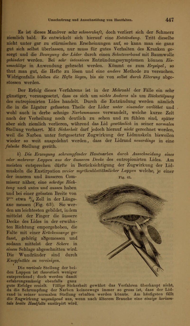 Es ist dieses Manöver sehr schmerzhaft, doch verliert sich der Schmerz ziemlich bald. Es entwickelt sich hierauf eine Entzündung. Tritt dieselbe nicht unter gar zu stürmischen Erscheinungen auf, so kann man sie ganz gut sich selbst überlassen, nur muss für gutes Verhalten des Kranken ge- sorgt und die Bewegung der Lider durch einen Schutzverband mit Baumwolle gehindert werden. Bei sehr intensiven Entzündungssymptomen können Eis- umschläge in Anwendung gebracht werden. Kömmt es zum Erysipel, so thut man gut, die Hefte zu lösen und eine andere Methode zu versuchen. Widrigenfalls bleiben die Hefte liegen, bis sie von selbst durch Eiterung abge- stossen werden. Der Erfolg dieses Verfahrens ist in der Mehrzahl der Eälle ein sehr günstiger, vorausgesetzt, dass es sich um nichts Anderes als um Rückstülpung des entropionirten Lides handelt. Durch die Entzündung werden nämlich die in die Ligatur gefassten Theile der Lider unter einander verlöthet und wohl auch in derbe sehnige Narbenmassen verwandelt, welche kurze Zeit nach der Verheilung noch deutlich zu sehen und zu fühlen sind, später aber sich ziemlich verlieren, während das Lid gewöhnlich in seiner normalen Stellung verharrt. Mit Sicherheit darf jedoch hierauf nicht gerechnet werden, weil die Narben unter fortgesetzter Zugwirkung der Lidmuskeln bisweüen wieder so weit ausgedehnt werden, dass der Lidrand neuerdings in eine falsche Stellung geräth. b) Die Erzeugung schrumpfender Hautnarben durch Ausschneidimg eines oder mehrerer Lappen aus der äusseren Decke des entropionirten Lides. Am meisten entsprechen dürfte in Berücksichtigung der Zugwirkung der Lid- muskeln die Exstirpation zweier myrthcnblattähnlicher Lappen welche, je einer der inneren und äusseren Com- missur näher, eine schräge Rich- tung nach unten und aussen haben und bei einer grössten Breite von 2' etwa 3/4 Zoll in der Längs- axe messen (Eig. 63). Sie wer- den am leichtesten gebildet, indem mittelst der Einger die äussere Decke des Lides in der erwähn- ten Richtung emporgehoben, die Falte mit einer Krückenzange ge- fasst, gehörig abgemessen und sodann mittelst der Schere in einem Schlage abgeschnitten wird. Die Wundränder sind durch Knopfnähte zu vereinigen. ■ Die verticale Stellung der bei- den Lappen ist theoretisch weniger entsprechend; doch werden damit erfahrungsmässig ebenfalls ganz gute Erfolge erzielt. Völlige Sicherheit gewährt das Verfahren überhaupt nicht, da die Schrumpfung der Narben keineswegs immer so gross ist, dass der Lid- rand in seiner normalen Stellung erhalten werden könnte. Am häufigsten fällt die Zugwirkung ungenügend aus, wenn nach älterem Brauche eine einzige horizon- tale breite Hautfalte exstirpirt wird. Fig. 63.