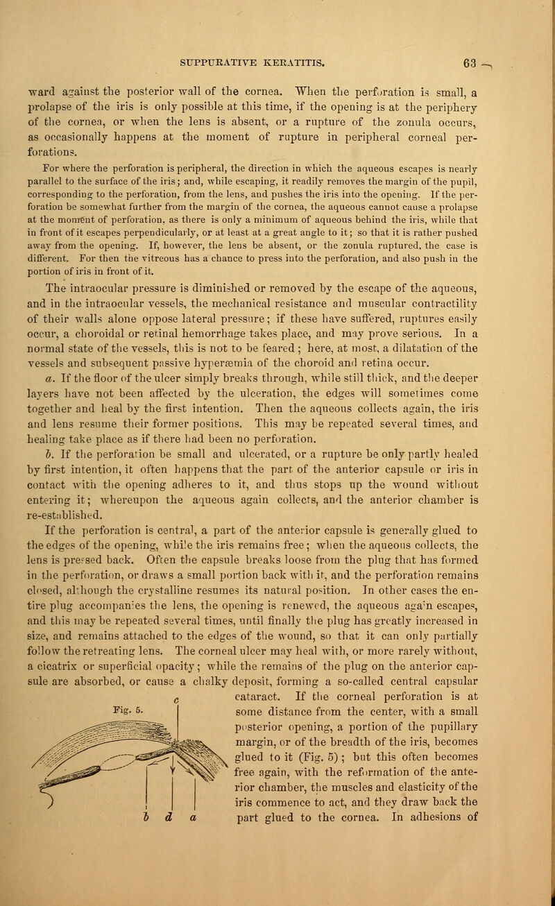 ward against the posterior wall of the cornea. When the perforation is small, a prolapse of the iris is only possible at this time, if the opening is at the periphery of the cornea, or when the lens is absent, or a rupture of the zonula occurs, as occasionally happens at the moment of rupture in peripheral corneal per- forations. For where the perforation is peripheral, the direction in which the aqueous escapes is nearly- parallel to the surface of the iris; and, while escaping, it readily removes the margin of the pupil, corresponding to the perforation, from the lens, and pushes the iris into the opening. If the per- foration be somewhat further from the margin of the cornea, the aqueous cannot cause a prolapse at the moment of perforation, as there is only a minimum of aqueous behind the iris, while that in front of it escapes perpendicularly, or at least at a great augle to it; so that it is rather pushed away from the opening. If, however, the lens be absent, or the zonula ruptured, the case is different. For then the vitreous has a chance to press into the perforation, and also push in the portion of iris in front of it. The intraocular pressure is diminished or removed by the escape of the aqueous, and in the intraocular vessels, the mechanical resistance and muscular contractility of their walls alone oppose lateral pressure; if these have suffered, ruptures easily occur, a choroidal or retinal hemorrhage takes place, and may prove serious. In a normal state of the vessels, this is not to be feared ; here, at most, a dilatation of the vessels and subsequent passive hyperemia of the choroid and retina occur. a. If the floor of the ulcer simply breaks through, while still thick, and the deeper layers have not been affected by the ulceration, the edges will sometimes come together and heal by the first intention. Then the aqueous collects again, the iris and lens resume their former positions. This may be repeated several times, and healing take place as if there had been no perforation. I. If the perforation be small and ulcerated, or a rupture be only partly healed by first intention, it often happens that the part of the anterior capsule or iris in contact with the opening adheres to it, and thus stops up the wound without entering it; whereupon the aqueous again collects, and the anterior chamber is re-established. If the perforation is central, a part of the anterior capsule is generally glued to the edges of the opening, while the iris remains free; when the aqueous collects, the lens is prefsed back. Often the capsule breaks loose from the plug that has formed in the perforation, or draws a small portion back with it, and the perforation remains closed, although the crystalline resumes its natural position. In other cases the en- tire plug accompanies the lens, the opening is renewed, the aqueous aga;n escapes, and this may be repeated several times, until finally the plug has greatly increased in size, and remains attached to the edges of the wound, so that it can only partially follow the retreating lens. The corneal ulcer may heal with, or more rarely without, a cicatrix or superficial opacity; while the remains of the plug on the anterior cap- sule are absorbed, or cause a chalky deposit, forming a so-called central capsular cataract. If the corneal perforation is at some distance from the center, with a small posterior opening, a portion of the pupillary margin, or of the breadth of the iris, becomes glued to it (Fig. 5) ; but this often becomes free again, with the reformation of the ante- rior chamber, the muscles and elasticity of the iris commence to act, and they draw back the part glued to the cornea. In adhesions of