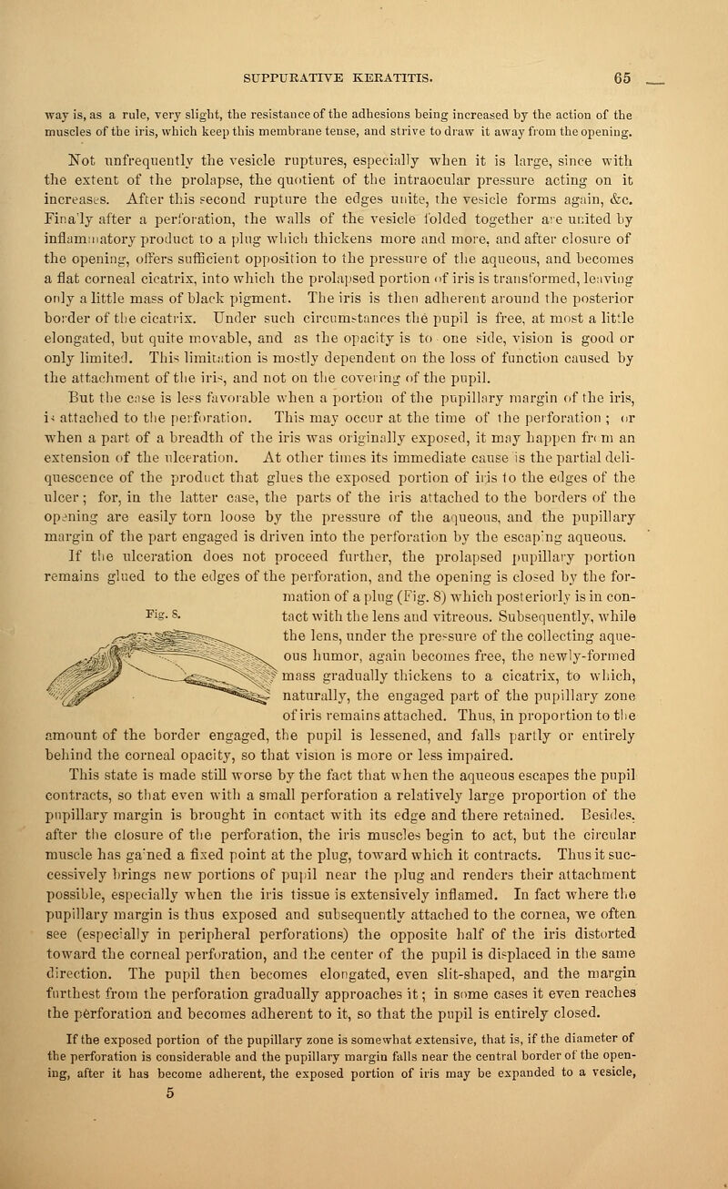 way is, as a rule, very slight, the resistance of the adhesions being increased by the action of the muscles of the iris, which keep this membrane tense, and strive to draw it away from the opening. Not unfrequently the vesicle ruptures, especially when it is large, since with the extent of the prolapse, the quotient of the intraocular pressure acting on it increases. After this second rupture the edges unite, the vesicle forms again, &c. Fina'ly after a perforation, the walls of the vesicle folded together ave united by inflammatory product to a plug which thickens more and more, and after closure of the opening, offers sufficient opposition to the pressure of the aqueous, and becomes a flat corneal cicatrix, into which the prolapsed portion of iris is transformed, leaving only a little mass of black pigment. The iris is then adherent around the posterior border of the cicatrix. Under such circumstances the pupil is free, at most a little elongated, but quite movable, and as the opacity is to one side, vision is good or only limited. This limitation is mostly dependent on the loss of function caused by the attachment of the iris, and not on the covering of the pupil. But the case is less favorable when a portion of the pupillary margin of the iris, i< attached to the perforation. This may occur at the time of the perforation ; or when a part of a breadth of the iris was originally exposed, it may happen fr< m an extension of the ulceration. At other times its immediate cause is the partial deli- quescence of the product that glues the exposed portion of iris 1o the edges of the ulcer; for, in the latter case, the parts of the iris attached to the borders of the opening are easily torn loose by the pressure of the aqueous, and the pupillary margin of the part engaged is driven into the perforation by the escaping aqueous. If the ulceration does not proceed further, the prolapsed pupillary portion remains glued to the edges of the perforation, and the opening is closed by the for- mation of a plug (Fig. 8) which posteriorly is in con- tact with the lens and vitreous. Subsequently, while the lens, under the pressure of the collecting aque- ous humor, again becomes free, the newly-formed mass gradually thickens to a cicatrix, to which, naturally, the engaged part of the pupillary zone of iris remains attached. Thus, in proportion to the amount of the border engaged, the pupil is lessened, and falls partly or entirely behind the corneal opacity, so that vision is more or less impaired. This state is made still worse by the fact that when the aqueous escapes the pupil contracts, so that even with a small perforation a relatively large proportion of the pupillary margin is brought in contact with its edge and there retained. Besides, after the closure of the perforation, the iris muscles begin to act, but the circular muscle has ga:ned a fixed point at the plug, toward which it contracts. Thus it suc- cessively brings new portions of pupil near the plug and renders their attachment possible, especially when the iris tissue is extensively inflamed. In fact where the pupillary margin is thus exposed and subsequently attached to the cornea, we often see (especially in peripheral perforations) the opposite half of the iris distorted toward the corneal perforation, and the center of the pupil is displaced in the same direction. The pupil then becomes elongated, even slit-shaped, and the margin furthest from the perforation gradually approaches it; in some cases it even reaches the perforation and becomes adherent to it, so that the pupil is entirely closed. If the exposed portion of the pupillary zone is somewhat extensive, that is, if the diameter of the perforation is considerable and the pupillary margin falls near the central border of the open- ing, after it has become adherent, the exposed portion of iris may be expanded to a vesicle, 5