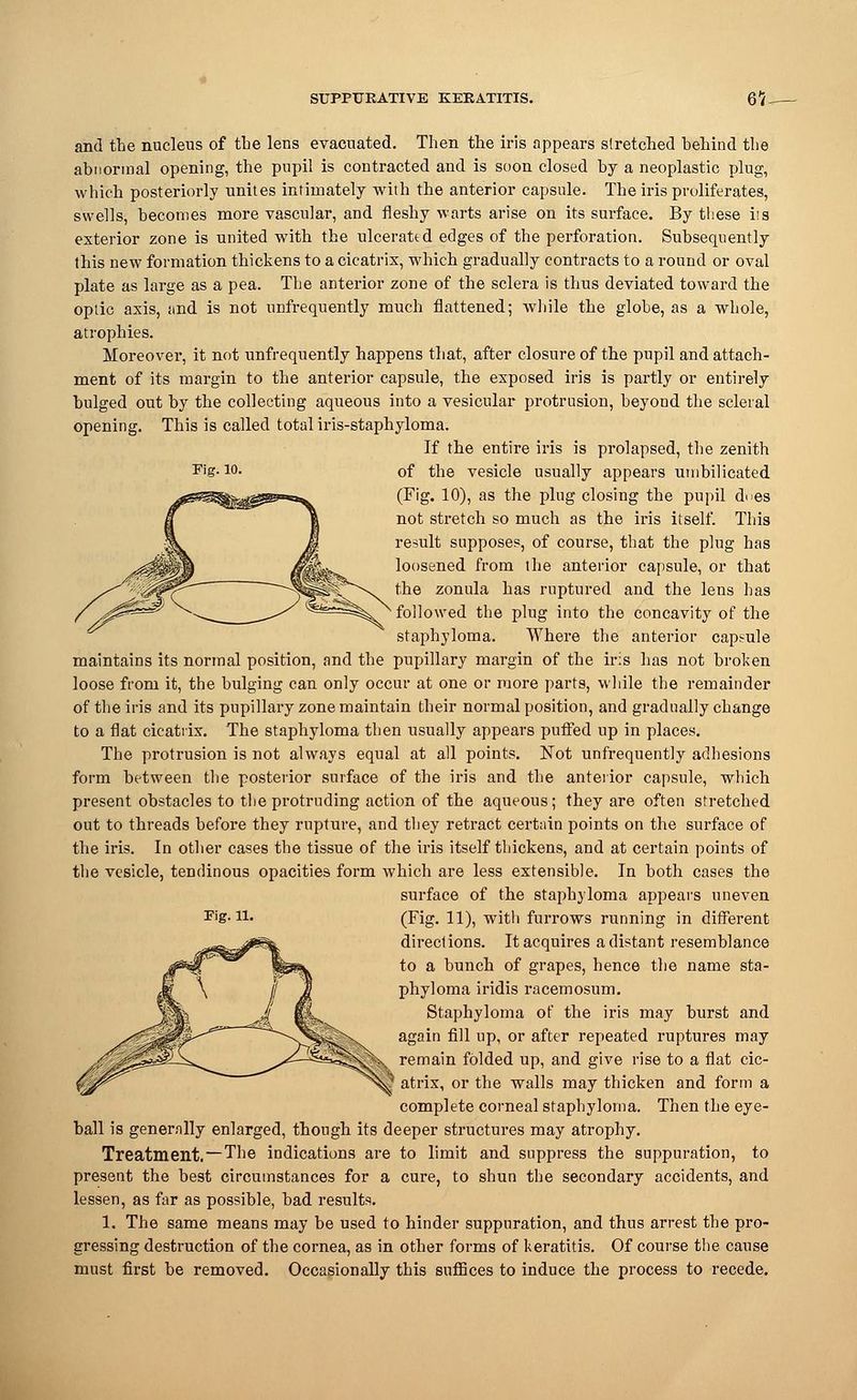 and the nucleus of the lens evacuated. Then the iris appears stretched behind the abnormal opening, the pupil is contracted and is soon closed by a neoplastic plug, which posteriorly unites intimately with the anterior capsule. The iris proliferates, swells, becomes more vascular, and fleshy warts arise on its surface. By these iis exterior zone is united with the ulcerated edges of the perforation. Subsequently this new formation thickens to a cicatrix, which gradually contracts to a round or oval plate as large as a pea. The anterior zone of the sclera is thus deviated toward the optic axis, and is not unfrequently much flattened; while the globe, as a whole, atrophies. Moreover, it not unfrequently happens that, after closure of the pupil and attach- ment of its margin to the anterior capsule, the exposed iris is partly or entirely bulged out by the collecting aqueous into a vesicular protrusion, beyond the scleral opening. This is called total iris-staphyloma. If the entire iris is prolapsed, the zenith Fig. 10. of the vesicle usually appears umbilicated (Fig. 10), as the plug closing the pupil dues not stretch so much as the iris itself. This result supposes, of course, that the plug has loosened from the anterior capsule, or that the zonula has ruptured and the lens has followed the plug into the concavity of the staphyloma. Where the anterior capsule maintains its normal position, and the pupillary margin of the ir:s has not broken loose from it, the bulging can only occur at one or more parts, while the remainder of the iris and its pupillary zone maintain their normal position, and gradually change to a flat cicatrix. The staphyloma then usually appears puffed up in places. The protrusion is not always equal at all points. Not unfrequently adhesions form between the posterior surface of the iris and the anterior capsule, which present obstacles to the protruding action of the aqueous; they are often stretched out to threads before they rupture, and they retract certain points on the surface of the iris. In other cases the tissue of the iris itself thickens, and at certain points of the vesicle, tendinous opacities form which are less extensible. In both cases the surface of the staphyloma appears uneven (Fig. 11), with furrows running in different directions. It acquires a distant resemblance to a bunch of grapes, hence the name sta- phyloma iridis racemosum. Staphyloma of the iris may burst and again fill up, or after repeated ruptures may remain folded up, and give rise to a flat cic- 1 atrix, or the walls may thicken and form a complete corneal staphyloma. Then the eye- ball is generally enlarged, though its deeper structures may atrophy. Treatment.-The indications are to limit and suppress the suppuration, to present the best circumstances for a cure, to shun the secondary accidents, and lessen, as far as possible, bad results. gressing destruction of the cornea, as in other forms of keratitis. Of course the cause must first be removed. Occasionally this suffices to induce the process to recede. Fig. n.