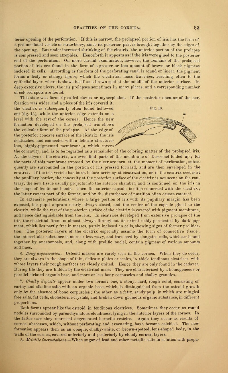 terior opening of the perforation. If this is narrow, the prolapsed portion of iris has the form of a pedunculated vesicle or strawberry, since its posterior part is brought together by the edges of the opening. But under increased shrinking of the cicatrix, the anterior portion of the prolapse is compressed and soon atrophies. Henceforth it appears as if the iris were glued to the posterior end of the perforation. On more careful examination, however, the remains of the prolapsed portion of iris are found in the form of a greater or less amount of brown or black pigment inclosed in cells. According as the form of the perforating canal is round or linear, the pigment forms a leafy or stringy figure, which the cicatritial mass traverses, reaching often to the epithelial layer, where it shows itself as a brown spot at the middle of the anterior surface. In deep extensive ulcers, the iris prolapses sometimes in many places, and a corresponding number of colored spots are found. This state was formerly called clavus or myocephalon. If the posterior opening of the per- foration was wider, and a piece of the iris covered it, the cicatrix is subsequently often found hollowed Eig. 13. out (fig. 13), while the anterior edge extends on a a level with the rest of the cornea. Hence the new formation developed on the prolapsed iris shows the vesicular form of the prolapse. At the edge of the posterior concave surface of the cicatrix, the iris i^ ^X\ \ is attached and connected with a delicate structure- less, highly-pigmented membrane, a, which covers the concavity, and is to be regarded as a remainder of the coloring matter of the prolapsed iris. At the edges of the cicatrix, we even find parts of the membrane of Descemet folded up ; for the parts of this membrane exposed by the ulcer are torn at the moment of perforation, subse- quently are surrounded in the portion of iris pressed forward, and are then enveloped in the cicatrix. If the iris vesicle has burst before arriving at cicatrization, or if the cicatrix occurs at the pupillary border, the concavity at the posterior surface of the cicatrix is not seen ; on the con- trary, the new tissue usually projects into the anterior chamber, and is continued on the iris in the shape of tendinous bands. Then the anterior capsule is often connected with the cicatrix; the latter covers part of the former, and by the disturbance of nutrition often causes cataract. In extensive perforations, where a large portion of iris with its pupillary margin has been exposed, the pupil appears nearly always closed, and the center of the capsule glued to the cicatrix, while the rest of the posterior surface of the cicatrix is covered with pigment membrane, and hence distinguishable from the lens. In cicatrices developed from extensive prolapse of the iris, the cicatritial tissue is almost always throughout its extent richly permeated by dark pig- ment, which lies partly free in masses, partly inclosed in cells, showing signs of former prolifica- tion. The posterior layers of the cicatrix especially assume the form of connective tissue; the intercellular substance is more or less wavy, and traversed by elongated cells, which are bound together by anastomosis, and, along with prolific nuclei, contain pigment of various amounts and hues. 6. Bony degeneration. Osteoid masses are rarely seen in the cornea. When they do occur, they are always in the shape of thin, delicate plates or scales, in thick tendinous cicatrices, with whose layers their rough surfaces are closely united. Hence they are only found in the cadaver. During life they are hidden by the cicatritial mass. They are characterized by a homogeneous or parallel striated organic base, and more or less bony corpuscles and chalky granules. 7. Chalky deposits appear under two forms: one, a stony, hard, rough solid, consisting of earthy and alkaline salts with an organic base, which is distinguished from the osteoid growth only by the absence of bone corpuscles; the other as a fatty, sandy pulp, in which are mingled free salts, fat cells, cholesterine crystals, and broken down grumous organic substance, in different proportions. Both forms appear like the osteoid in tendinous cicatrices. Sometimes they occur as round nodules surrounded by parenchymatous cloudiness, lying in the anterior layers of the cornea. In the latter case they represent degenerated herpetic vesicles. Again they occur as results of corneal abscesses, which, without perforating and evacuating, have become calcified. The new formation appears then as an opaque, chalky-white, or brown-spotted, lens-shaped body, in the walls of the cornea, covered anteriorly and posteriorly by cloudy corneal layers. 8. Metallic incrustations.—When sugar of lead and other metallic salts in solution with prepa-