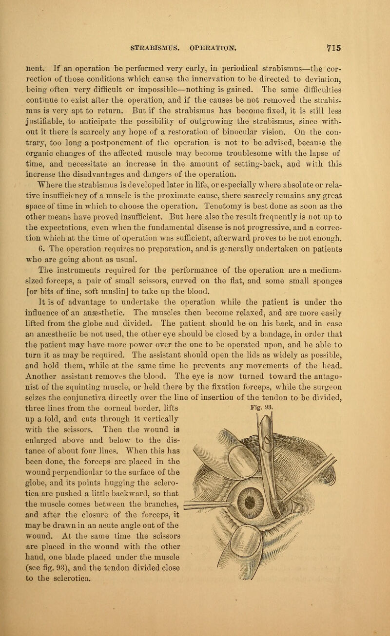 nent. If an operation be performed very early, in periodical strabismus—the cor- rection of those conditions which cause the innervation to be directed to deviation, being often very difficult or impossible—nothing is gained. The same difficulties continue to exist after the operation, and if the causes be not removed the strabis- mus is very apt to return. But if the strabismus has become fixed, it is still less justifiable, to anticipate the possibility of outgrowing the strabismus, since with- out it there is scarcely any hope of a restoration of binocular vision. On the con- trary, too long a postponement of the operation is not to be advised, because the organic changes of the affected muscle may become troublesome with the lapse of time, and necessitate an increase in the amount of setting-back, and with this increase the disadvantages and dangers of the operation. Where the strabismus is developed later in life, or especially where absolute or rela- tive insufficiency of a muscle is the proximate cause, there scarcely remains any great space of time in which to choose the operation. Tenotomy is best done as soon as the other means have proved insufficient. But here also the result frequently is not up to the expectations, even when the fundamental disease is not progressive, and a correc- tion which at the time of operation was sufficient, afterward proves to be not enough. 6. The operation requires no preparation, and is generally undertaken on patients who are going about as usual. The instruments required for the performance of the operation are a medium- sized forceps, a pair of small scissors, curved on the flat, and some small sponges [or bits of fine, soft muslin] to take up the blood. It is of advantage to undertake the operation while the patient is under the influence of an anaesthetic. The muscles then become relaxed, and are more easily lifted from the globe and divided. The patient should be on his back, and in case an anaesthetic be not used, the other eye should be closed by a blindage, in order that the patient may have more power over the one to be operated upon, and be able to turn it as may be required. The assistant should open the lids as widely as possible, and hold them, while at the same time he prevents any movements of the head. Another assistant removes the blond. The eye is now turned toward the antago- nist of the squinting muscle, or held there by the fixation forceps, while the surgeon seizes the conjunctiva directly over the line of insertion of the tendon to be divided, three lines from the corneal border, lifts up a fold, and cuts through it vertically with the scissors. Then the wound is enlarged above and below to the dis- tance of about four lines. When this has been done, the forceps are placed in the wound perpendicular to the surface of the globe, and its points hugging the sclero- tica are pushed a little backward, so that the muscle comes between the branches, and after the closure of the forceps, it maybe drawn in an acute angle out of the wound. At the same time the scissors are placed in the wound with the other hand, one blade placed under the muscle (see fig. 93), and the tendon divided close to the sclerotica.