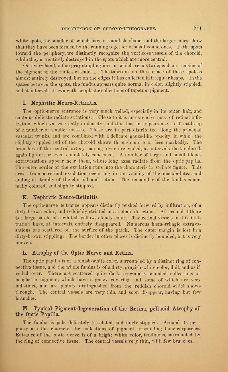 white spots, the smaller of which, have a roundish shape, and the larger ones show that they have been formed by the running together of small round ones. In the spots toward the periphery, we distinctly recognize the vorticose vessels of the choroid, while they are entirely destroyed in the spots which are more central. On every hand, a fine gray stippling is seen, which seems todepend on remains of the pigment of the tunica vasculosa. Thetapetum on the surface of these spots is almost entirely destroyed, but on the edges it has collected in irregular heaps. In the spaces between the spots, the fundus appears quite normal in color, slightly stippled, and at intervals strewn with neoplastic collections of tapetum pigment. I. Nephritic Neuro-Retinitis. The optic-nerve entrance is very much veiled, especially in its outer half, and contains delicate radiate striations. Close to it is an extensive mass of retinal infil- tration, which varies greatly in density, and thus has an appearance as if made up of a number of smaller masses. These are in part distributed along the principal vascular trunks, and are combined with a delicate gauze-like opacity, in which the slightly stippled red of the choroid shows through more or less markedly. The branches of the central artery passing over are veiled, at intervals dark-colored, again lighter, or even completely concealed. A number of large and small blood- extravasations appear near tiiem, whose long axes radiate from the optic papilla. The outer border of the exudation runs into the characteristic stellate figure. This arises from a retinal exud ition occurring in the vicinity of the macula-lutea, and ending in atrophy of the choroid and retina. The remainder of the fundus is nor- mally colored, and slightly stippled. K. Nephritic Neuro-Retinitis. The optic-nerve entrance appears distinctly pushed forward by infiltration, of a dirty-brown color, and reddishly striated in a radiate direction. Ail around it there is a large patch, of a whitish-yellow, cloudy color. The retinal vessels in this infil- tration have, at intervals, entirely disappeared. Numerous hemorrhagic extrava- sations are scattered on the surface of the patch. The outer margin is lost in a dirty-brown stippling. The border in other places is distinctly bounded, but is very uneven. L. Atrophy of the Optic Nerve and Retina. The optic papilla is of a bluish-white color, surrounded by a distinct ring of con- nective tissue, and the whole fundus is of a dirty, yrayish-white color, dull, and as if veiled over. There a-e scattered quite dark, irregularly-bounded collections of neoplastic pigment, which have a gauzy covering, and some of which are very indistinct, and are plainly distinguished from the reddish choroid which shows through. The central vessels are very thin, and soon disappear, having but lew branches. M. Typical Pigment-degeneration of the Retina, pellucid Atrophy of the Optic Papilla. The fundus is pale, delicately tesselated, and finely stippled. Around its peri- phery are the characterise collections of pigment, resembling bone-corpuscles. Entrance of the optic nerve is of a bright white color, tendinous, surrounded by the ring of connective tissue. The central vessels very thin, with few branches.