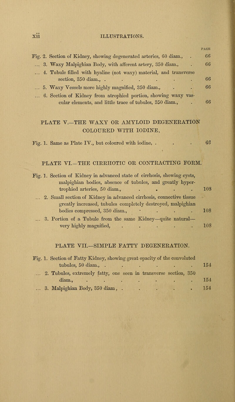 PAGE Fig. 2. Section of Kidney, showing degenerated arteries, 60 diani., . 66 ... 3. Waxy Malpighian Body, with afferent artery, 350 diam., . 66 ... 4. Tubule filled with hyaline (not waxy) material, and transverse section, 350 diam., ...... 66 ... 5. Waxy Vessels more highly magnified, 350 diam., . . 66 ... 6. Section of Kidney from atrophied portion, showing waxy vas- cular elements, and little trace of tubules, 350 diam., . 66 PLATE V.—THE WAXY OR AMYLOID DEGENERATION COLOURED WITH IODINE, Eig. 1. Same as Plate IV., but coloured with iodine, . PLATE VI.—THE CIRRHOTIC OR CONTRACTING FORM. Fig. 1. Section of Kidney in advanced state of cirrhosis, showing cysts, malpighian bodies, absence of tubules, and greatly hyper- trophied arteries, 50 diam., .... 108 ... 2. Small section of Kidney in advanced cirrhosis, connective tissue greatly increased, tubules completely destroyed, malpighian bodies compressed, 350 diam., • 108 ... 3. Portion of a Tubule from the same Kidney—quite natural— very highly magnified, . . . . .108 PLATE VII.—SIMPLE FATTY DEGENERATION. Fig. 1. Section of Fatty Kidney, showing great opacity of the convoluted tubules, 50 diam., ...... 154 ... 2. Tubules, extremely fatty, one seen in transverse section, 350 diam., ..... . 154 ... 3. Malpighian Body, 350 diam, . . . . .154