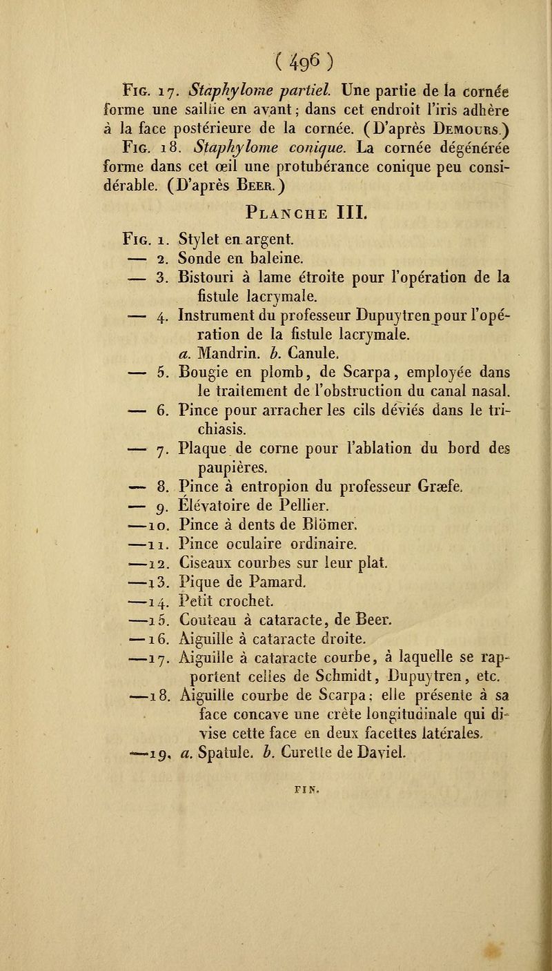 Fig. 17. Staphylome partiel. Une partie de la cornde forme une saillie en avant ; dans cet endroit l'iris adhère à la face postérieure de la cornée. (D'après Demours.) Fig. 18. Staphylome conique. La cornée dégénérée forme dans cet œil une protubérance conique peu consi- dérable. (D'après Béer.) Planche IIL Fig. 1. Stylet en argent. — 2. Sonde en baleine. — 3. Bistouri à lame étroite pour l'opération de la fistule lacrymale. — 4. Instrument du professeur Dupuytren pour l'opé- ration de la fistule lacrymale. a. Mandrin, b. Canule. — 5. Bougie en plomb, de Scarpa, employée dans le traitement de l'obstruction du canal nasal. — 6. Pince pour arracher les cils déviés dans le tri- chiasis. — 7. Plaque de corne pour l'ablation du bord des paupières. — 8. Pince à entropion du professeur Grsefe. — 9. Elévatoire de Pellier. —10. Pince à dents de Blomer, —11. Pince oculaire ordinaire. —12. Ciseaux courbes sur leur plat. —r3. Pique de Pamard, —14. Petit crochet. —15. Couteau à cataracte, de Béer. —16. Aiguille à cataracte droite. —17. Aiguille à cataracte courbe, à laquelle se rap- portent celles de Schmidt, Dupuytren, etc. —18. Aiguille courbe de Scarpa; elle présente à sa face concave une crête longitudinale qui di- vise cette face en deux facettes latérales- -—19, a. Spatule, b. Curette de Daviel.