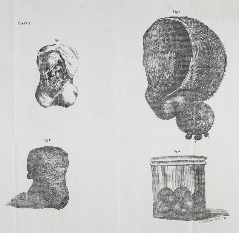 Fig 2 Figs Fig 4 T^^^^'' -tk't^