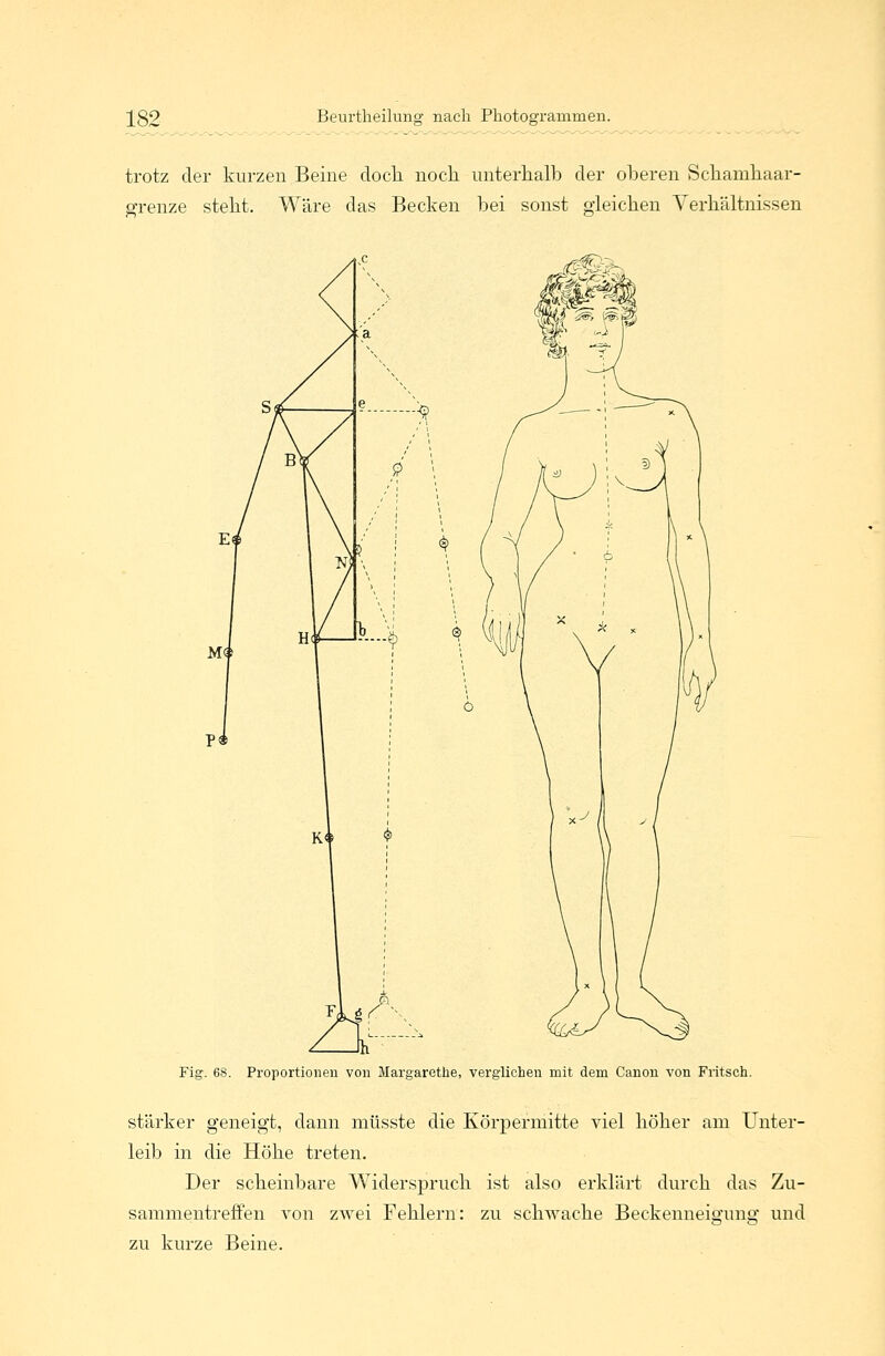 trotz der kurzen Beine doch, noch unterhalb der oberen Schamhaar- grenze steht. Wäre das Becken bei sonst gleichen Verhältnissen Fig. 68. Proportionen von Margarethe, verglichen mit dem Canon von Fritsch. stärker geneigt, dann müsste die Körpermitte viel höher am Unter- leib in die Höhe treten. Der scheinbare Widerspruch ist also erklärt durch das Zu- sammentreffen von zwei Fehlern: zu schwache Beckenneigung und zu kurze Beine.