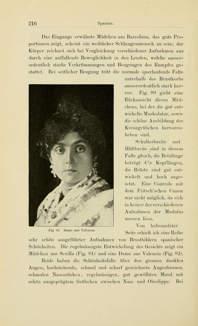 Das Eingangs erwähnte Mäclclien aus Barcelona, das gute Pro- portionen zeigt, scheint ein weiblicher Schlangenmensch zu sein; der Körper zeichnet sich bei Vergleichung verschiedener Aufnahmen aus durch eine auffallende Beweglichkeit in den Lenden, welche ausser- ordentlich starke Verkrümmungen und Beugungen des Rumpfes ge- stattet. Bei seitlicher Beugung tritt die normale querlaufende Falte unterhalb des Brustkorbs ausserordentlich stark her- vor. Fig. 80 giebt eine Rückansicht dieses Mäd- chens, bei der die gut ent- wickelte Muskulatur, sowie die schöne Ausbildung der Kreuzgrübchen hervorzu- heben sind. Schulterbreite und Hüftbreite sind in diesem Falle gleich, die Beinlänge beträgt 4 ^2 Kopflängen, die Brüste sind gut ent- wickelt und hoch ange- setzt. Eine Controle mit dem Fritsch'schen Canon war nicht möglich, da sich in keiner der verschiedenen Aufnahmen der Modulus messen Hess. Von befreundeter Seite erhielt ich eine Reihe sehr schön ausgeführter Aufnahmen von Brustbildern spanischer Schönheiten. Die regelmässigste Entwickelung des Gesichts zeigt ein Mädchen aus Sevilla (Fig. 81) und eine Dame aus Valencia (Fig. 82). Beide haben die Schönheitsfalte über den grossen dunklen Augen, hochstehende, schmal und scharf gezeichnete Augenbrauen, schmalen Nasenrücken, regelmässigen, gut gewölbten Mund mit schön ausgeprägtem Grübchen zwischen Nase und Oberlippe. Bei Dame aus Valencia.