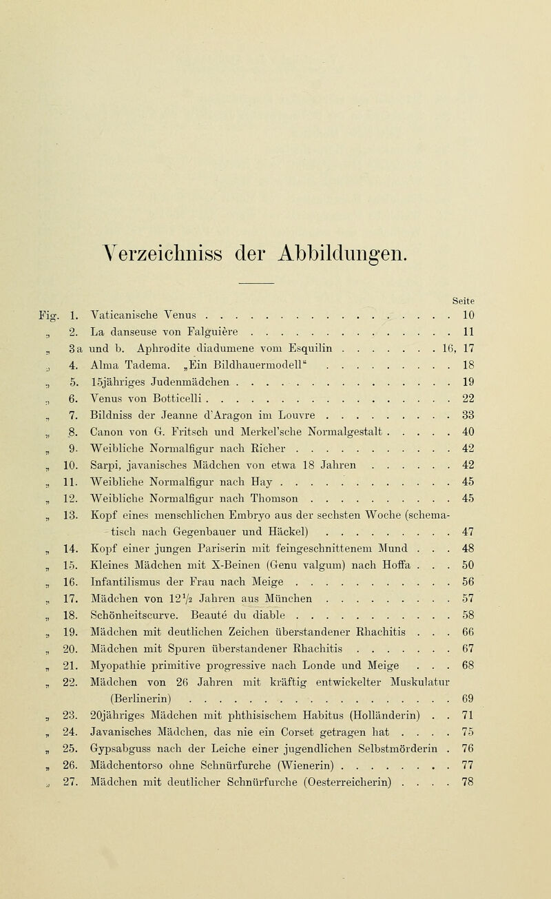 Verzeichniss der Abbildungen. Seite Fig. 1. Vaticanische Venus 10 ., 2. La danseuse von Falguiere 11 „ 3 a und b. Aphrodite diadumene vom Esquilin 16, 17 ., 4. Alma Tadema. „Ein Bildhauermodell 18 ., 5. löjähriges Judenmädchen 19 ., 6. Venus von Botticelli 22 ., 7. Bildniss der Jeanne d1 Aragon im Louvre 33 ,, 8. Canon von G. Fritsch und Merkel'sche Normalgestalt 40 „ 9- Weibliche Normalfigur nach Ei eher 42 ,, 10. Sarpi, javanisches Mädchen von etwa 18 Jahren 42 ;, 11. Weibliche Normalfigur nach Hay 45 „ 12. Weibliche Normalfigur nach Thomson 45 „ 13. Kopf eines menschlichen Embryo aus der sechsten Woche (schema- tisch nach Gegenbauer und Häckel) 47 „ 14. Kopf einer jungen Pariserin mit feingeschnittenem Mund ... 48 ,, 15. Kleines Mädchen mit X-Beinen (Genu valgum) nach Hoffa ... 50 ., 16. Infantilismus der Frau nach Meige 56 ., 17. Mädchen von 121J2 Jahren aus München 57 „ 18. Schönheitscurve. Beaute du diable 58 ., 19. Mädchen mit deutlichen Zeichen überstandener Rhachitis ... 66 ., 20. Mädchen mit Spuren überstandener Rhachitis 67 „ 21. Myopathie primitive progressive nach Londe und Meige ... 68 ,, 22. Mädchen von 26 Jahren mit kräftig entwickelter Muskulatur (Berlinerin) 69 .j 23. 20jähriges Mädchen mit phthisischem Habitus (Holländerin) . . 71 „ 24. Javanisches Mädchen, das nie ein Corset getragen hat .... 75 „ 25. Gypsabguss nach der Leiche einer jugendlichen Selbstmörderin . 76 „ 26. Mädchentorso ohne Schnürfurche (Wienerin) 77 ,, 27. Mädchen mit deutlicher Schnürfurche (Oesterreicherin) .... 78