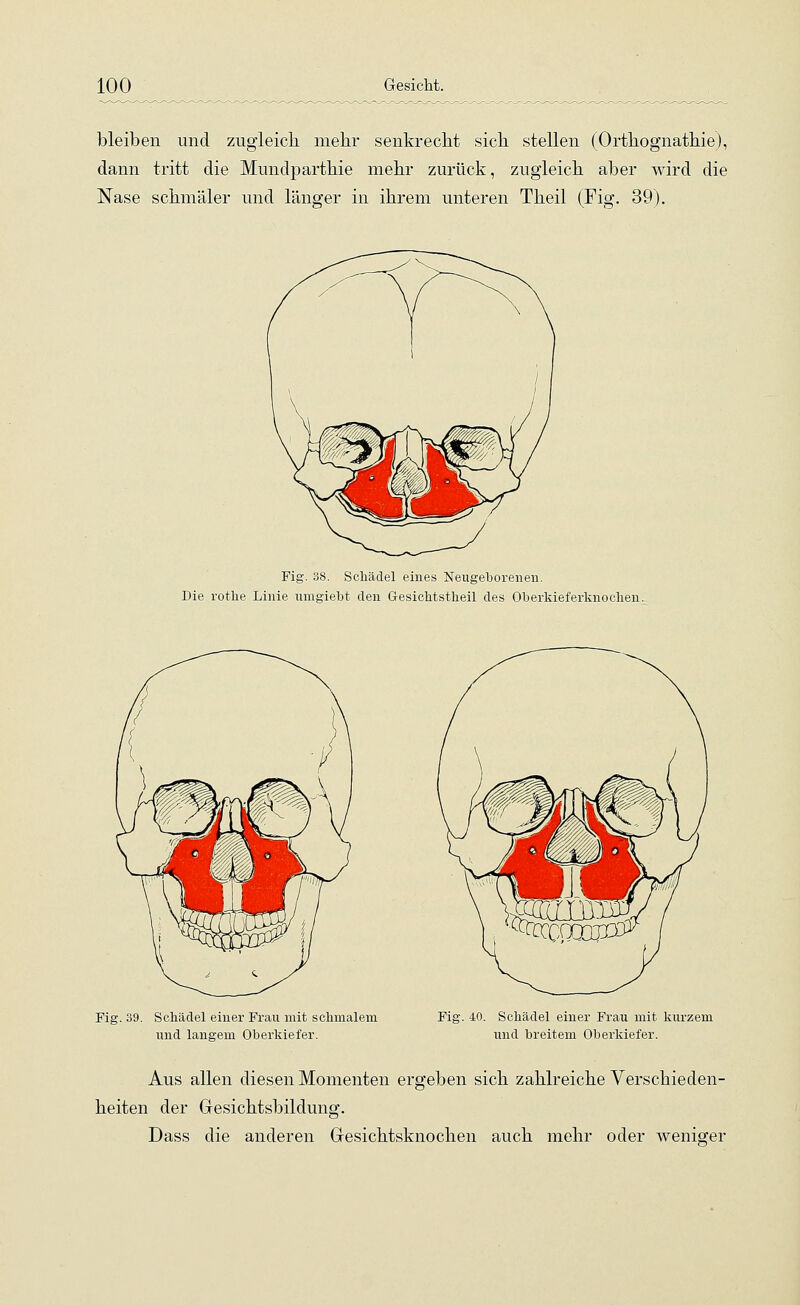 bleiben und zugleich mehr senkrecht sich stellen (Orthognathie), dann tritt die Mundparthie mehr zurück, zugleich aber wird die Nase schmäler und länger in ihrem unteren Theil (Fig. 39). Fig. 38. Schädel eines Neugeborenen. Die rotlie Linie umgiebt den G-esichtstkeil des Oberkieferknochen. Fig. 39. Schädel einer Frau mit schmalem und langem Oberkiefer. Fig. 40. Schädel einer Frau mit kurzem und breitem Oberkiefer. Aus allen diesen Momenten ergeben sich zahlreiche Verschieden- heiten der Gesichtsbildung. Dass die anderen Gesichtsknochen auch mehr oder weniger