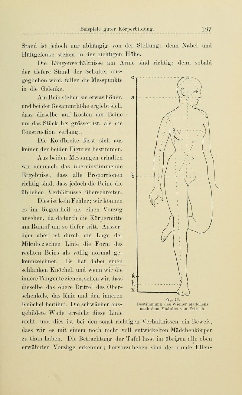 Stand ist jedoch nur abhängig von der Stellung; denn Nabel und Hüftgelenke stehen in der richtigen Höhe. Die Längenverhältnisse am Arme sind richtig; denn sobald der tiefere Stand der Schulter aus- geglichen wird, fallen die Messpunkte in die Gelenke. Am Bein stehen sie etwas höher, und bei der Gesammthöhe ergiebt sich, dass dieselbe auf Kosten der Beine um das Stück hx grösser ist, als die Construction verlangt. Die Kopfbreite lässt sich aus keiner der beiden Figuren bestimmen. Aus beiden Messungen erhalten wir demnach das übereinstimmende Ergebniss, dass alle Proportionen richtig sind, dass jedoch die Beine die üblichen Verhältnisse überschreiten. Dies ist kein Fehler; wir können es im Gegentheil als einen Vorzug ansehen, da dadurch die Körpermitte am Rumpf um so tiefer tritt. Ausser- dem aber ist durch die Lage der Mikulicz'schen Linie die Form des rechten Beins als völlig normal ge- kennzeichnet. Es hat dabei einen schlanken Knöchel, und wenn wir die innere Tangente ziehen, sehen wir, dass dieselbe das obere Drittel des Ober- schenkels, das Knie und den inneren Knöchel berührt. Die schwächer aus- gebildete Wade erreicht diese Linie Fig. 76. Bestimmung des Wiener Mädchens nach dem Modulus von Fritsch. nicht, und dies ist bei den sonst richtigen Verhältnissen ein Beweis, dass wir es mit einem noch nicht voll entwickelten Mädchenkörper zu thun haben. Die Betrachtung der Tafel lässt im übrigen alle oben erwähnten Vorzüge erkennen; hervorzuheben sind der runde Ellen-