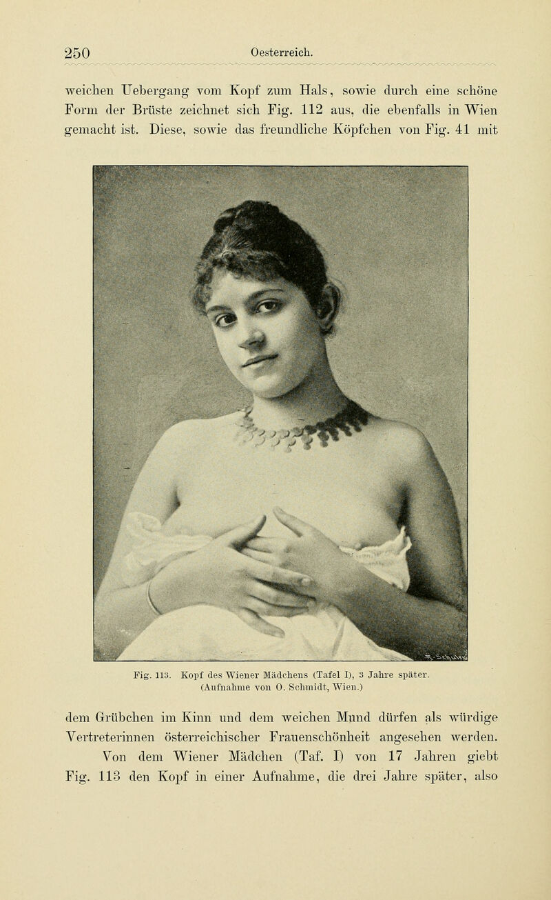 weichen Uebergang vom Kopf zum Hals, sowie durch, eine schöne Form der Brüste zeichnet sich Fig. 112 aus, die ebenfalls in Wien gemacht ist. Diese, sowie das freundliche Köpfchen von Fig. 41 mit Fig. 113. Kopf des Wiener Mädchens (Tafel I), 3 Jahre später. (Aufnahme von 0. Schmidt, Wien.) dem Grübchen im Kinn und dem weichen Mund dürfen als würdige Vertreterinnen österreichischer Frauenschönheit angesehen werden. Von dem Wiener Mädchen (Taf. I) von 17 Jahren giebt Fig. 113 den Kopf in einer Aufnahme, die drei Jahre später, also