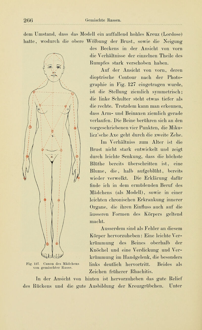 dem Umstand, dass das Modell ein auffallend hohles Kreuz (Lordose) hatte, wodurch die obere Wölbung der Brust, sowie die Neigung des Beckens in der Ansicht von vorn die Verhältnisse der einzelnen Theile des Rumpfes stark verschoben haben. Auf der Ansicht von vorn, deren dioptrische Contour nach der Photo- graphie in Fig. 127 eingetragen wurde, ist die Stellung ziemlich symmetrisch; die linke Schulter steht etwas tiefer als die rechte. Trotzdem kann man erkennen, dass Arm- und Beinaxen ziemlich gerade verlaufen. Die Beine berühren sich an den vorgeschriebenen vier Punkten, die Miku- licz'sche Axe geht durch die zweite Zehe. Im Verhältniss zum Alter ist die Brust nicht stark entwickelt und zeigt durch leichte Senkung, dass die höchste Blüthe bereits überschritten ist, eine Blume, die, halb aufgeblüht, bereits wieder verwelkt. Die Erklärung dafür finde ich in dem ermüdenden Beruf des Mädchens (als Modell), sowie in einer leichten chronischen Erkrankung innerer Organe, die ihren Einfluss auch auf die äusseren Formen des Körpers geltend macht. Ausserdem sind als Fehler an diesem Körper hervorzuheben: Eine leichte Ver- krümmung des Beines oberhalb der Knöchel und eine Verdickung und Ver- krümmung im Handgelenk, die besonders links deutlich hervortritt. Beides als Zeichen früherer Rhachitis. In der Ansicht von hinten ist hervorzuheben das gute Relief des Rückens und die gute Ausbildung der Kreuzgrübchen. Unter Fig. 127. Canon des Mädchens von gemischter Rasse.