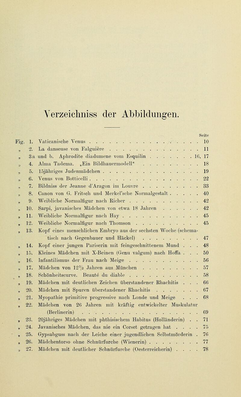 Verzeichniss der Abbildungen. Seite Fig. 1. Vaticanisclie Venus 10 ., 2. La danseuse von Falguiere 11 „ 3 a und b. Aphrodite diadumene vom Esquilin 16, 17 ., 4. Alma Tadema. „Ein Bildhauermodell 18 „ 5. ISjähriges Judenmädchen 19 ., 6. Venus von Botticelli 22 „ 7. Bildniss der Jeanne d'Aragon im Louvre 33 „ 8. Canon von G. Fritscli und Merkel'sche Normalgestalt 40 ^ 9- Weibliche Normalfigur nach Richer 42 „ 10. Sarpi, javanisches Mädchen von etwa 18 Jahren 42 „ 11. Weibliche Normalfigur nach Hay .45 , 12. Weibliche Normalfigur nach Thomson 45 „ 18. Kopf eines menschlichen Embryo aus der sechsten Woche (schema- tisch nach Gegenbauer und Häckel) 47 „ 14. Kopf einer jungen Pariserin mit feingeschnittenem Mund ... 48 „ 15. Kleines Mädchen mit X-Beinen (Genu valgum) nach Hoffa ... 50 „ 16. Infantilismus der Frau nach Meige 56 „ 17. Mädchen von 12 Va Jahren aus München . 57 „ 18. Schönheitscurve. Beaute du diable 58 „ 19. Mädchen mit deutlichen Zeichen überstandener Rhachitis ... 66 „ 20. Mädchen mit Spuren überstandener Rhachitis 67 „ 21. Myopathie primitive progressive nach Londe und Meige ... 68 „ 22. Mädchen von 26 Jahren mit kräftig entwickelter Muskulatur (Berlinerin) 69 „ 23. 20jähriges Mädchen mit phthisischem Habitus (Holländerin) . . 71 „ 24. Javanisches Mädchen, das nie ein Corset getragen hat . . . . 75 „ 25. Gypsabguss nach der Leiche einer jugendlichen Selbstmörderin . 76 „ 26. Mädchentorso ohne Schnürfurche (Wienerin) 77 ;, 27. Mädchen mit deutlicher Schnürfurche (Oesterreicherin) .... 78