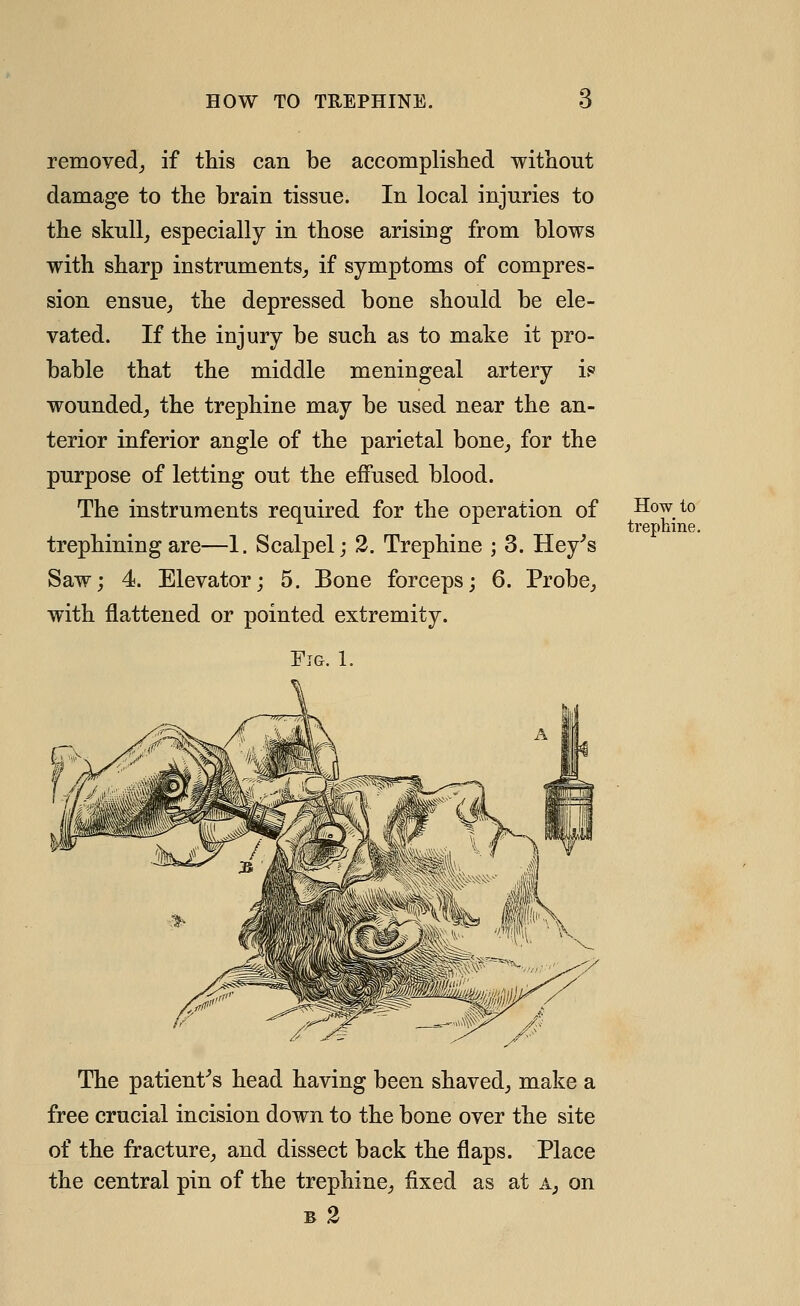 removed^ if this can be accomplished without damage to the brain tissue. In local injuries to the skull, especially in those arising from blows with sharp instruments, if symptoms of compres- sion ensue, the depressed bone should be ele- vated. If the injury be such as to make it pro- bable that the middle meningeal artery w wounded, the trephine may be used near the an- terior inferior angle of the parietal bone, for the purpose of letting out the effused blood. The instruments required for the operation of trephining are—1. Scalpel; 2. Trephine ; 3. Hey^s Saw; 4. Elevator; 5. Bone forceps; 6. Probe, with flattened or pointed extremity. Fig. 1. The patient^s head having been shaved, make a free crucial incision down to the bone over the site of the fracture, and dissect back the flaps. Place the central pin of the trephine, fixed as at a, on B 2 How to trephine.