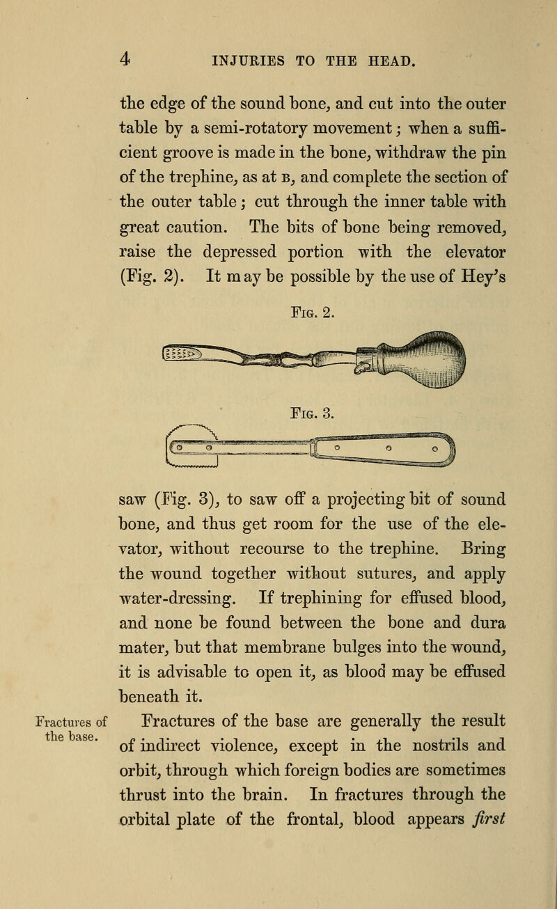 the edge of the sound bone, and cut into the outer table by a semi-rotatory movement; when a suffi- cient groove is made in the bone^ withdraw the pin of the trephine,, as at b, and complete the section of the outer table; cut through the inner table with great caution. The bits of bone being removed, raise the depressed portion with the elevator (Fig. 2). It may be possible by the use of Hey's Fig. 2. Fig. 3. saw (Fig. 3), to saw off a projecting bit of sound bone, and thus get room for the use of the ele- vator, without recourse to the trephine. Bring the wound together without sutures, and apply water-dressing. If trephining for effused blood, and none be found between the bone and dura mater, but that membrane bulges into the wound, it is advisable to open it, as blood may be effused beneath it. Fractures of Fracturcs of the base are generally the result of indirect violence, except in the nostrils and orbit, through which foreign bodies are sometimes thrust into the brain. In fractures through the orbital plate of the frontal, blood appears first