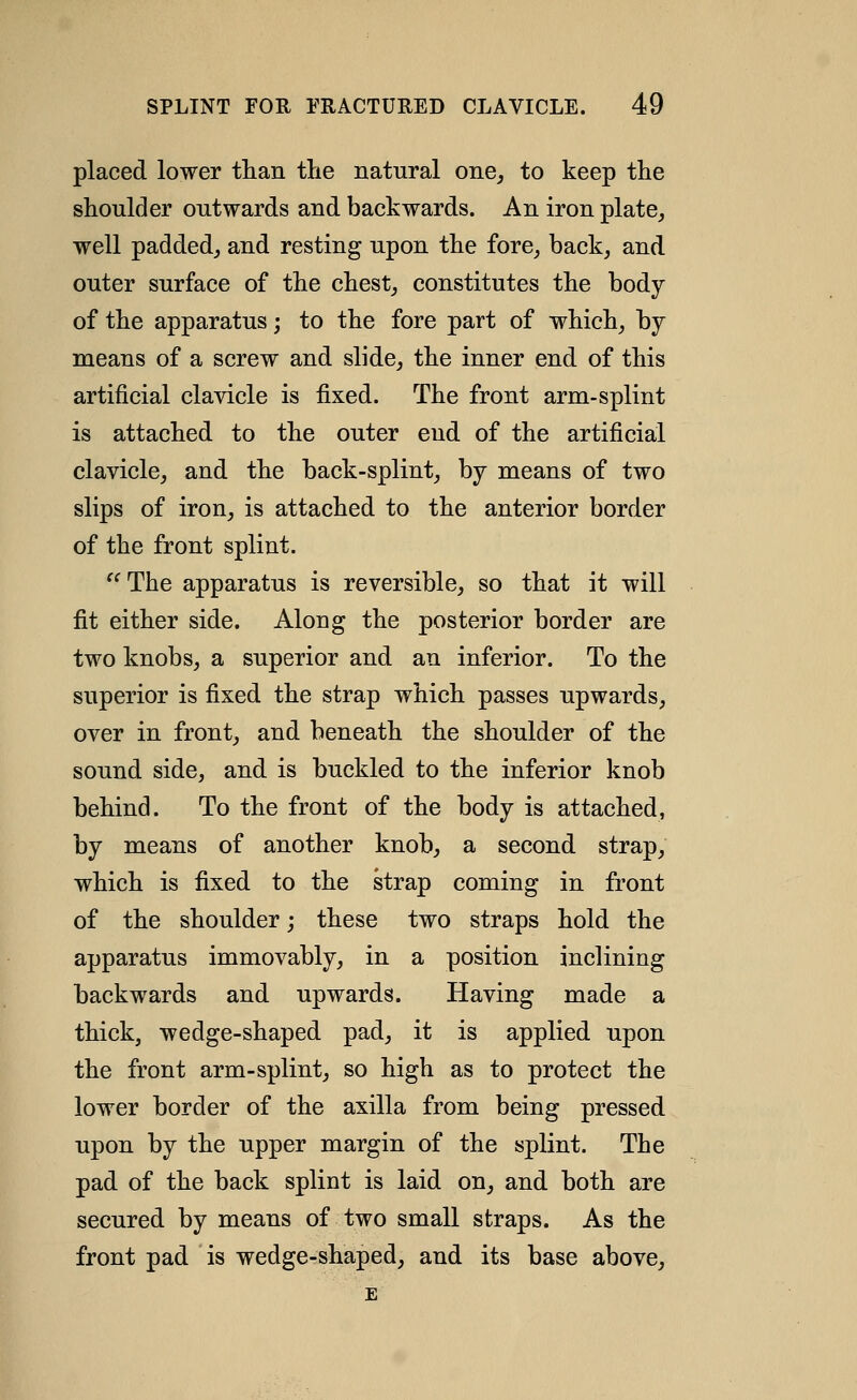 placed lower tlian tlie natural one^ to keep the shoulder outwards and backwards. An iron plate, well padded, and resting upon the fore, back, and outer surface of the chest, constitutes the body of the apparatus; to the fore part of which, by means of a screw and slide, the inner end of this artificial clavicle is fixed. The front arm-splint is attached to the outer end of the artificial clavicle, and the back-splint, by means of two slips of iron, is attached to the anterior border of the front splint. ^^The apparatus is reversible, so that it will fit either side. Along the posterior border are two knobs, a superior and an inferior. To the superior is fixed the strap which passes upwards, over in front, and beneath the shoulder of the sound side, and is buckled to the inferior knob behind. To the front of the body is attached, by means of another knob, a second strap, which is fixed to the strap coming in front of the shoulder; these two straps hold the apparatus immovably, in a position inclining backwards and upwards. Having made a thick, wedge-shaped pad, it is applied upon the front arm-splint, so high as to protect the lower border of the axilla from being pressed upon by the upper margin of the splint. The pad of the back splint is laid on, and both are secured by means of two small straps. As the front pad is wedge-shaped, and its base above.